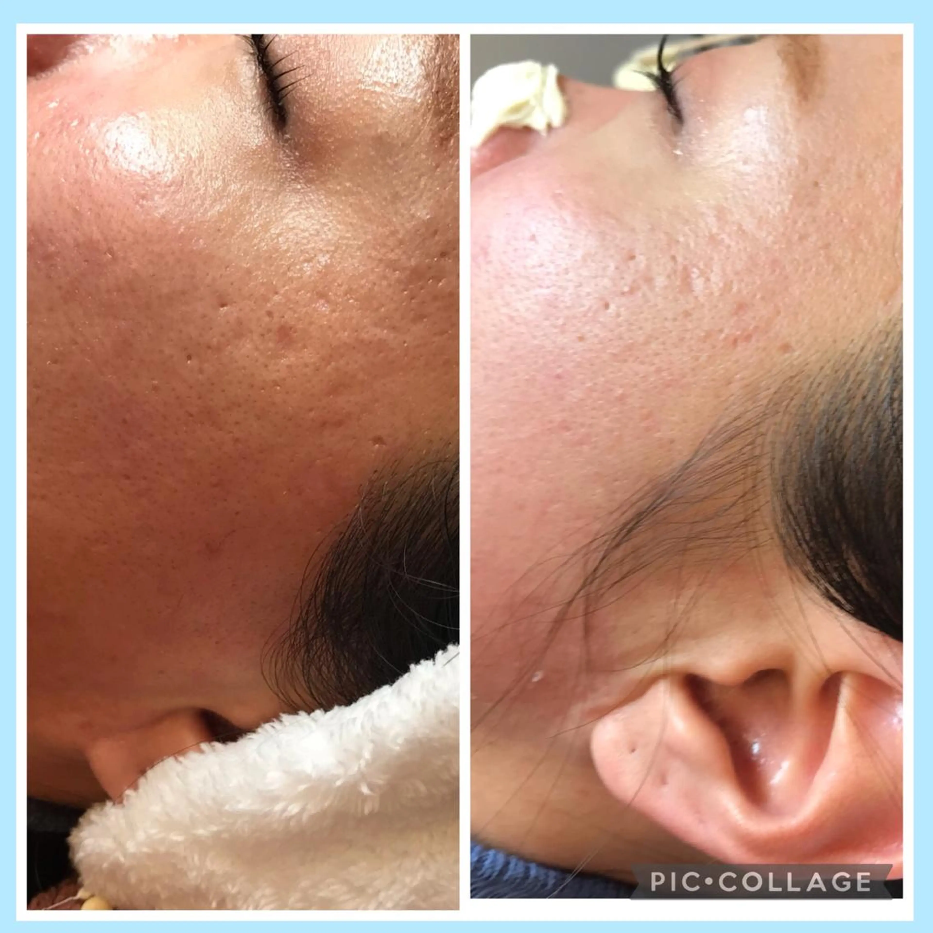 脱毛 🌊🌊__ juna__のマツエク・マツパデザイン