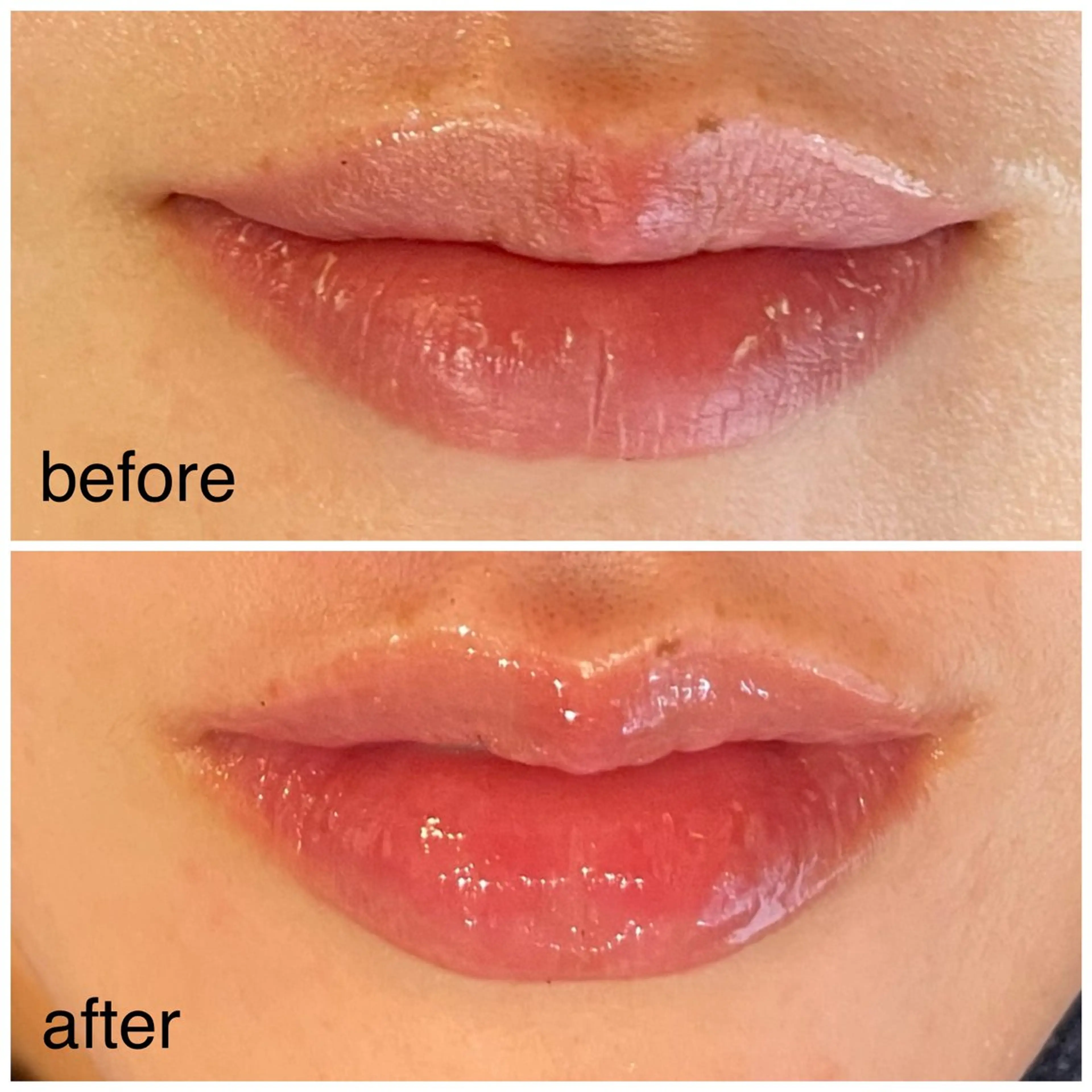 leolo武蔵浦和 肌質改善＆脱毛のエステ・リラクイメージ