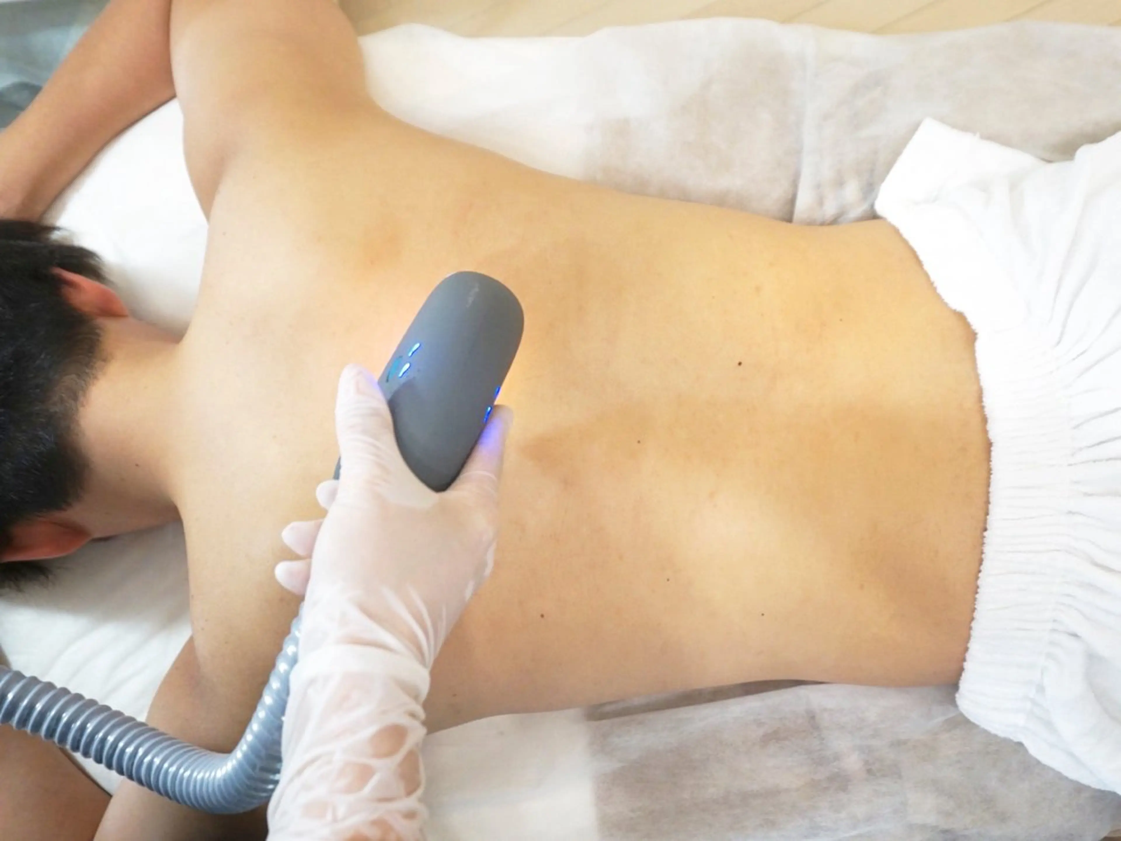 お試し都度１回　メンズ全身脱毛の写真
