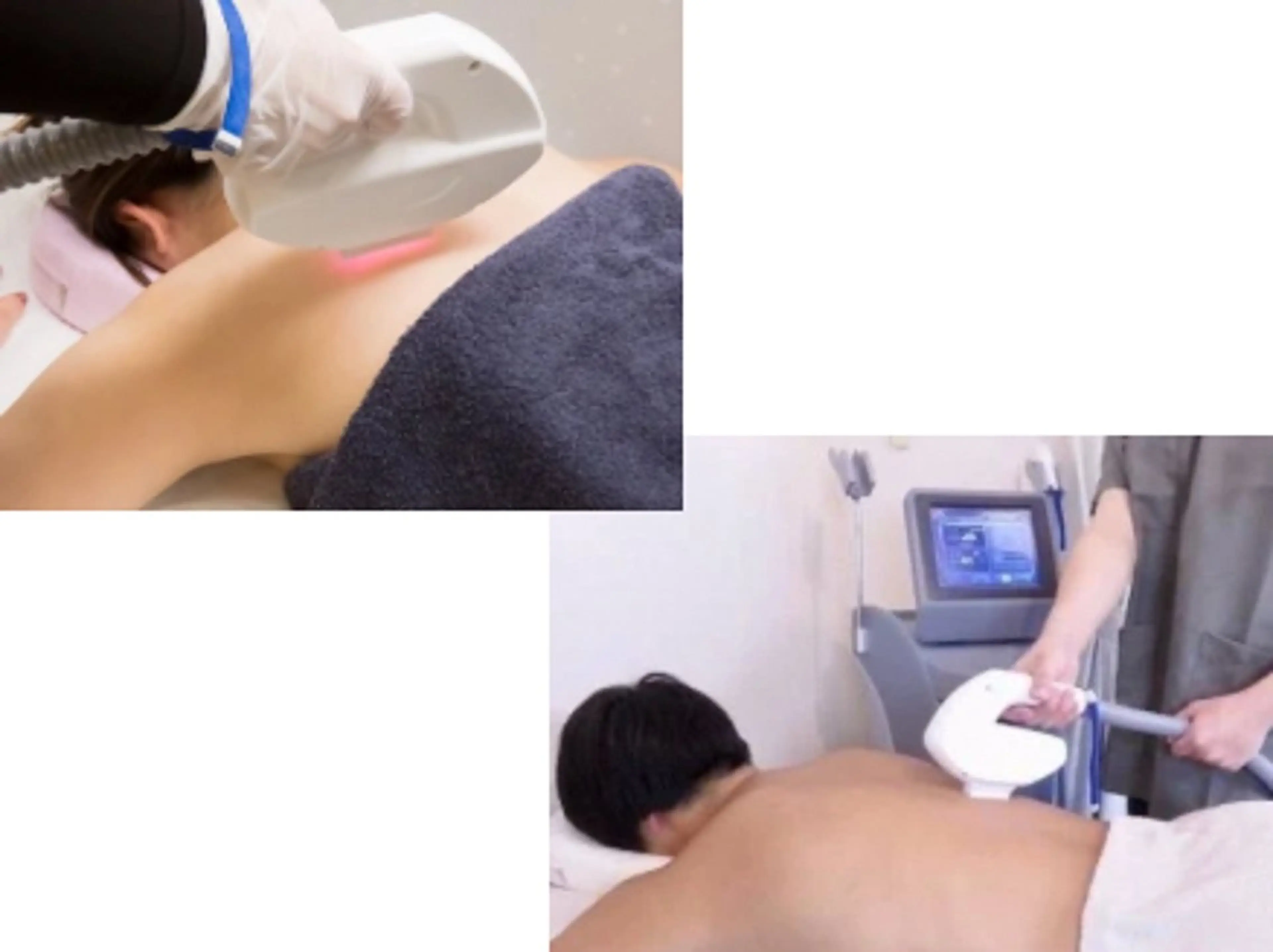 【再来予約専用】25歳以下全身脱毛の写真