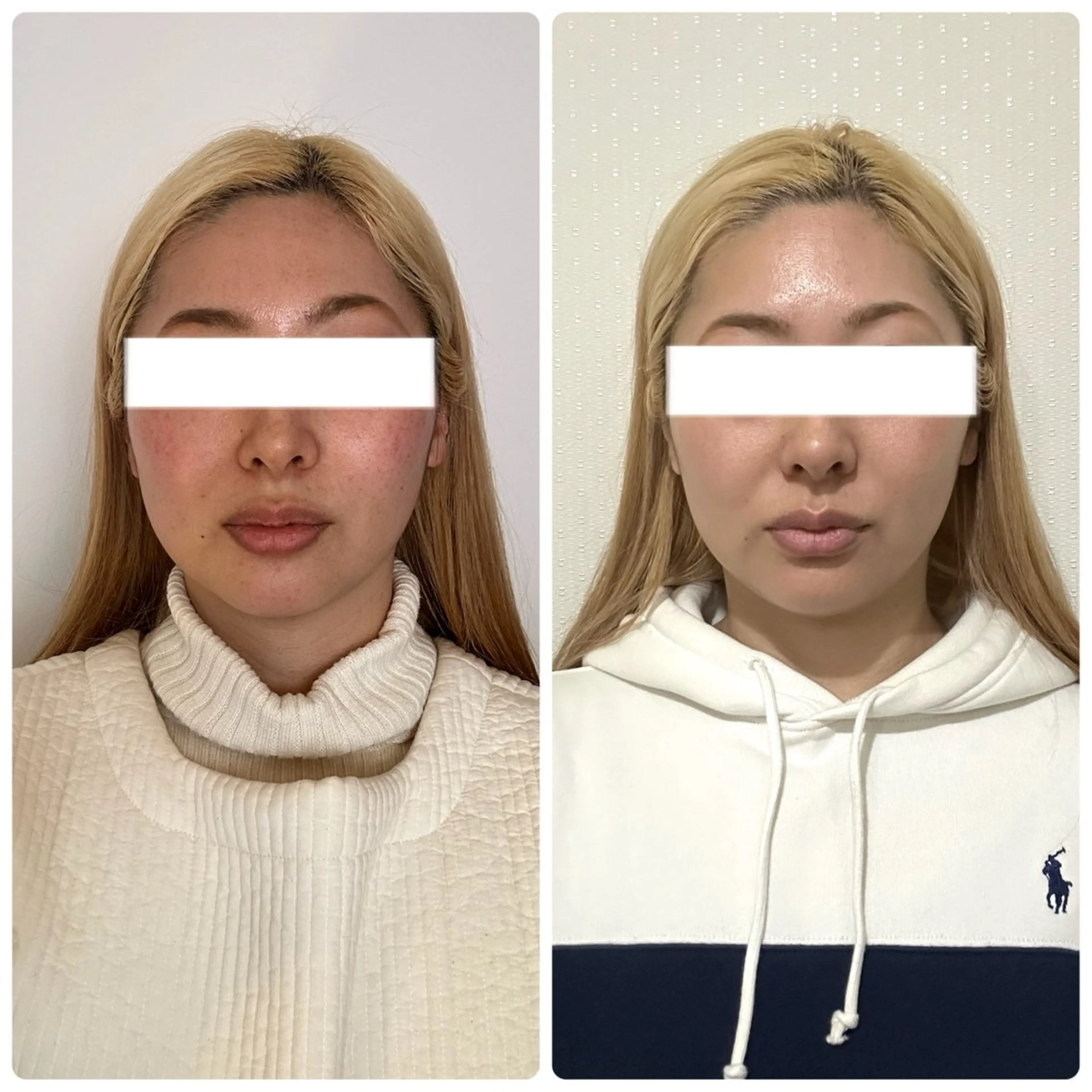 LUNA eye & beauty (ルナ アイ アンド ビューティー)所属・Kawakami Ericoのエステ・リラクイメージ