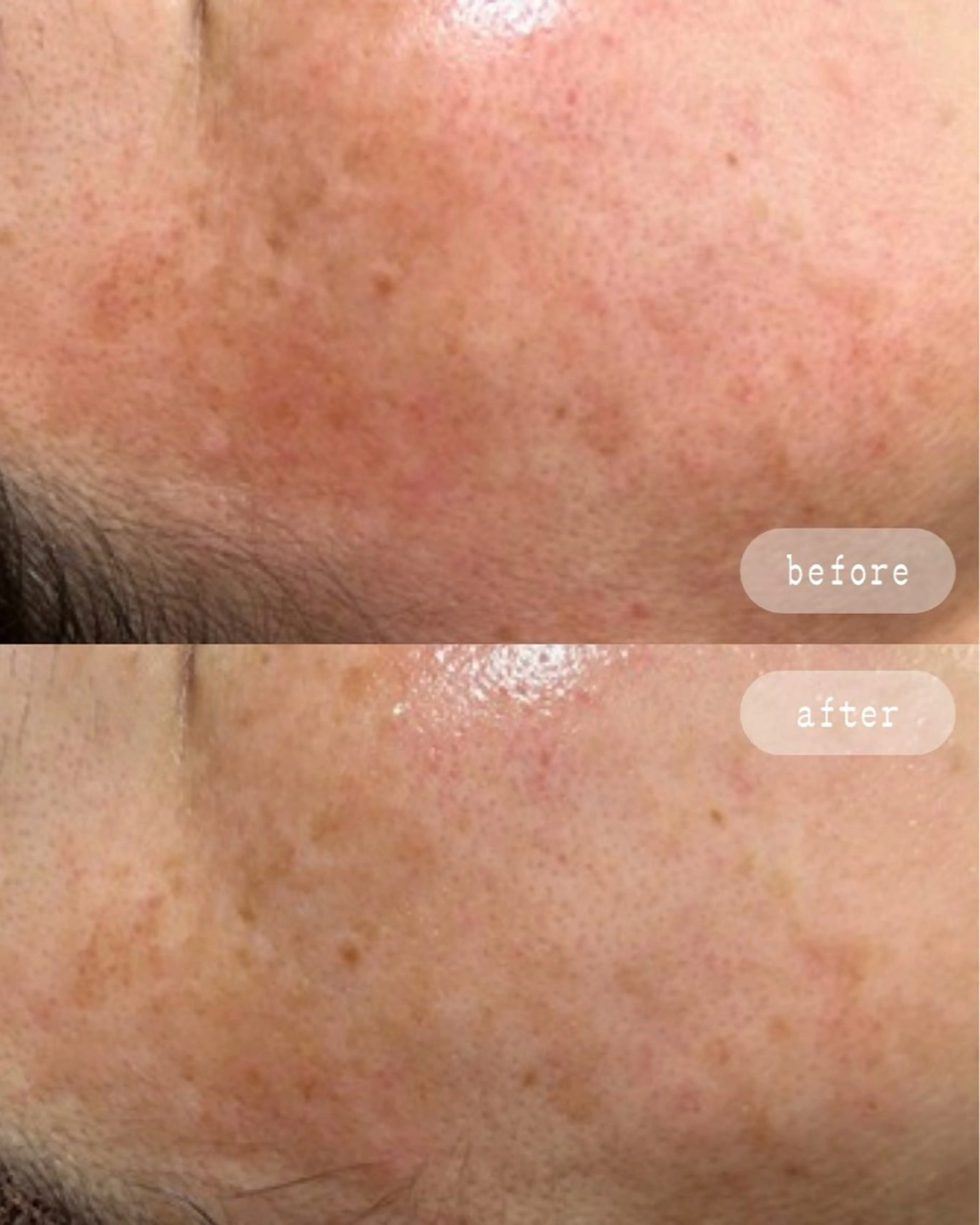 エステ LaVibe ann.のエステ・リラクイメージ