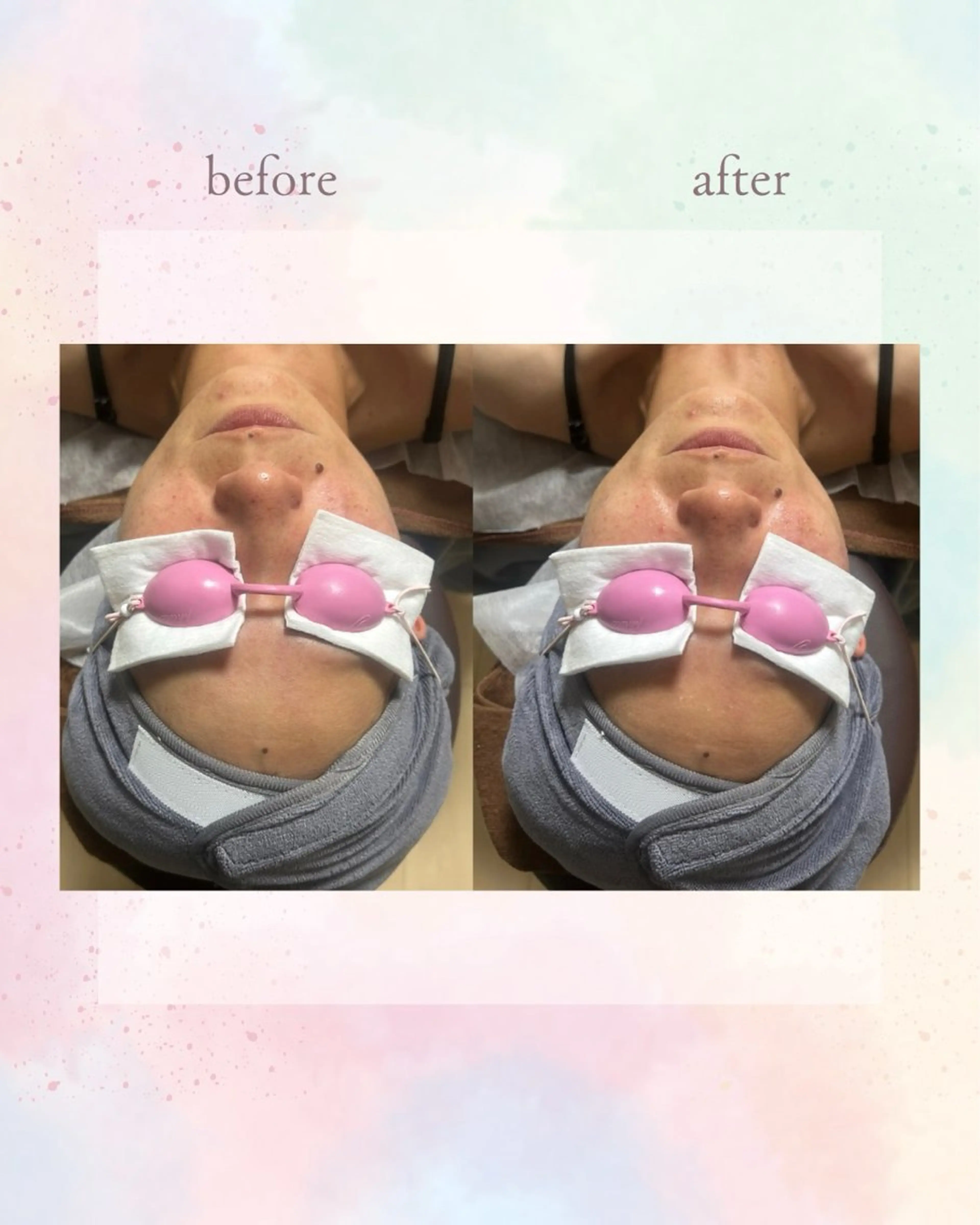 Belle ＋vi（ベル）のその他イメージ