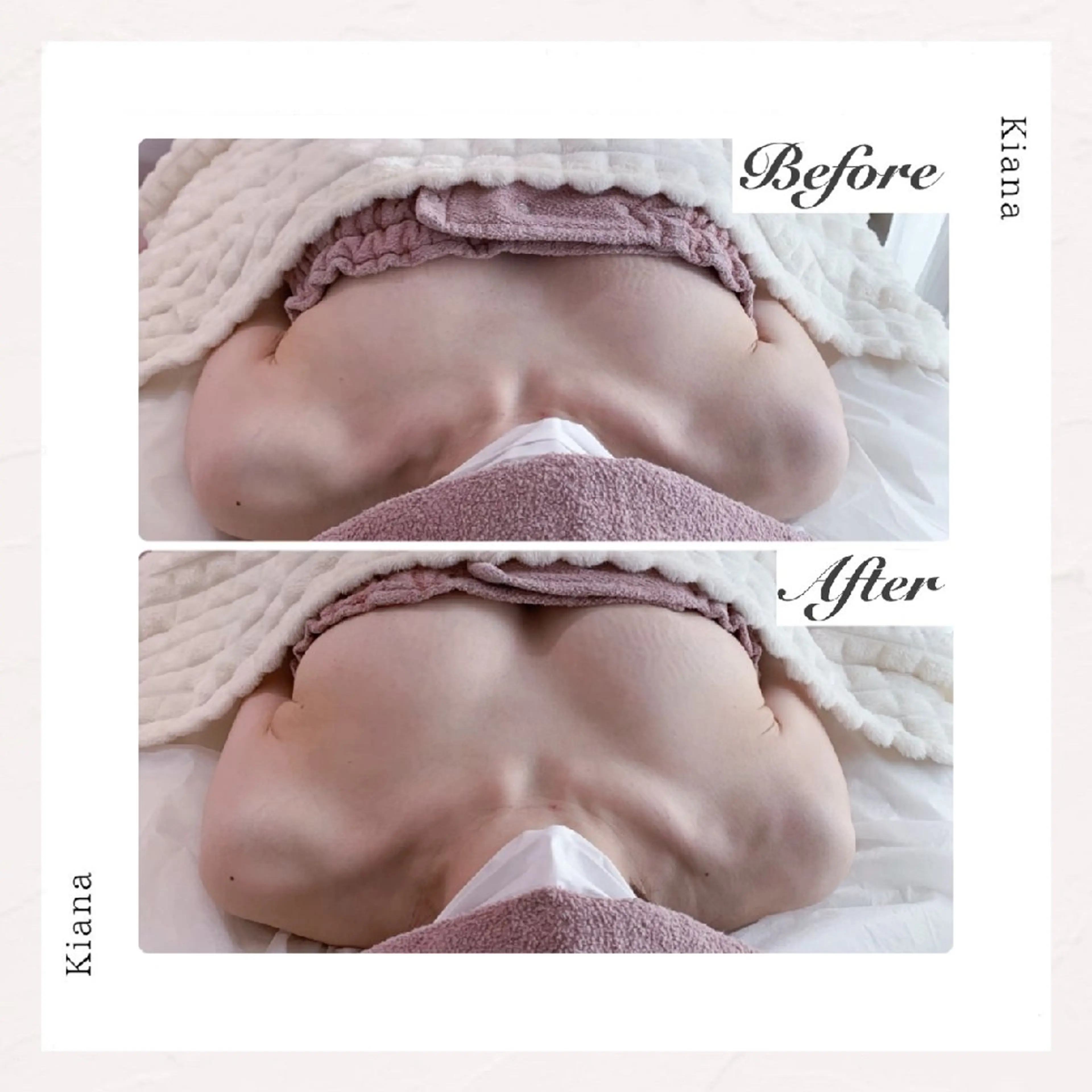 【バスト専門店 】 Kiana のエステ・リラクイメージ