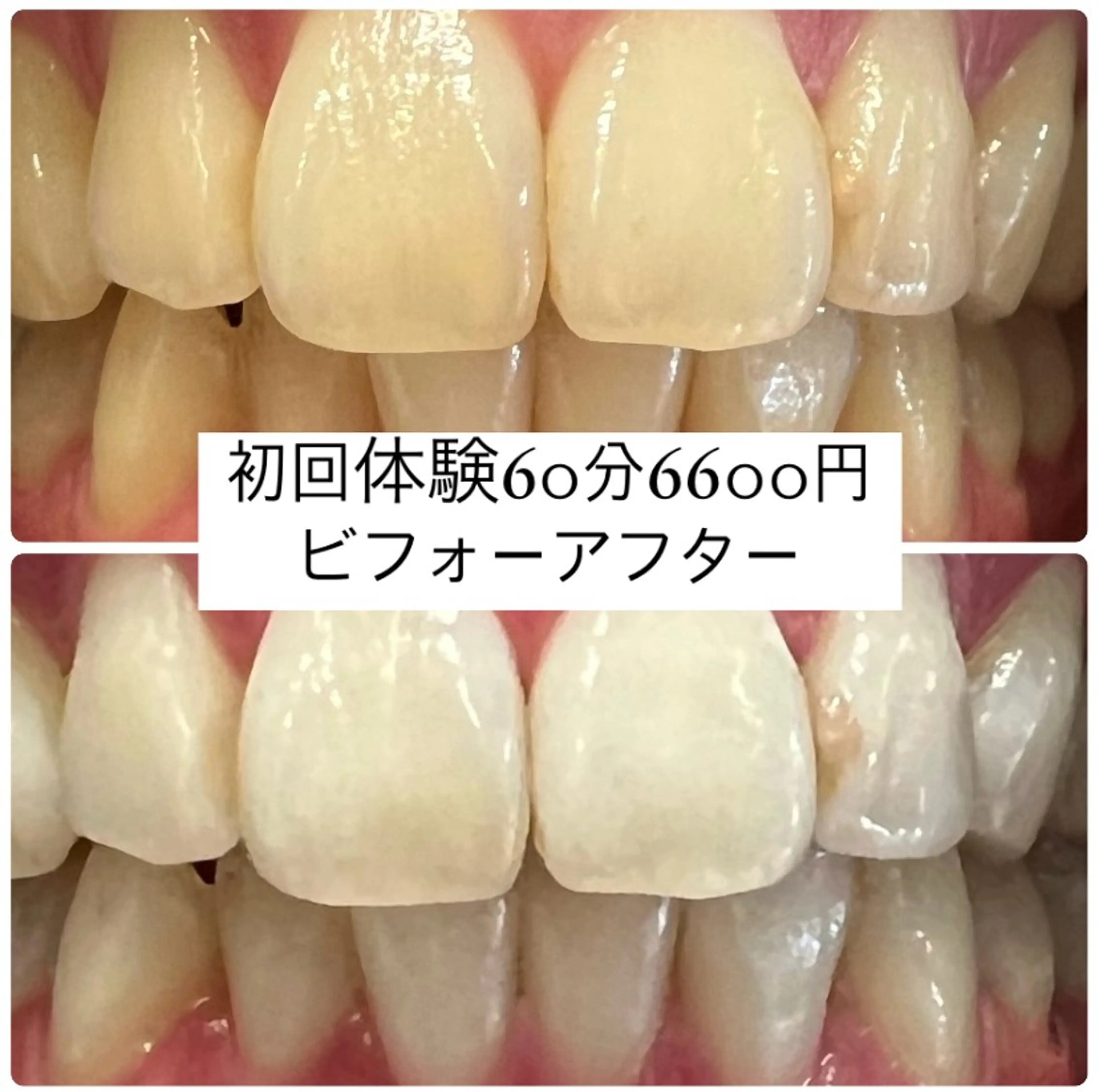 エステ PLATINUM Beauty 横浜店所属・ホワイトニングルーム 横浜店のその他イメージ