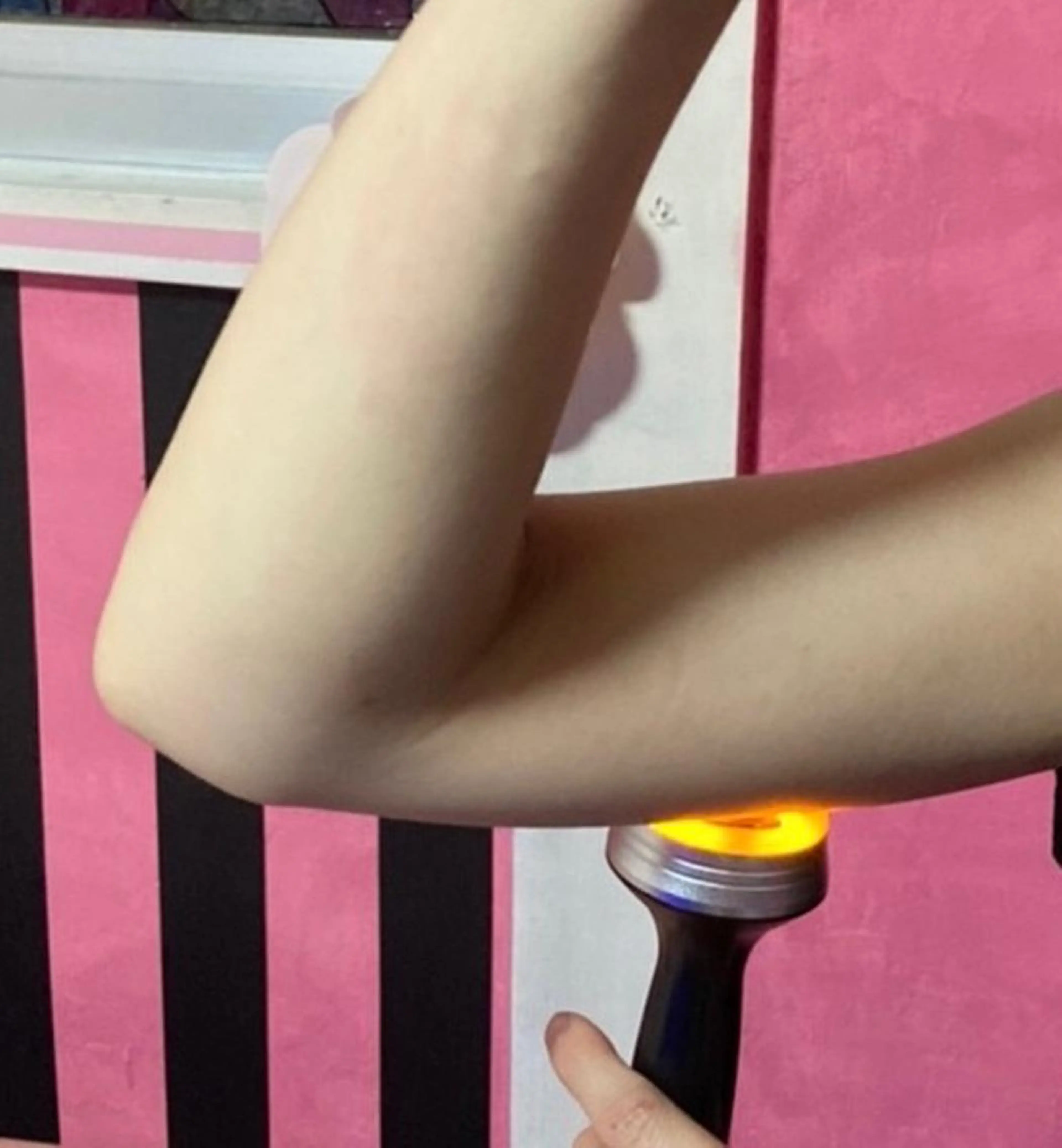 🌸本格的セルフエステ🌸60分使い放題❣🍀二の腕（6回）🍀 月2回でお好きな日に♪の写真