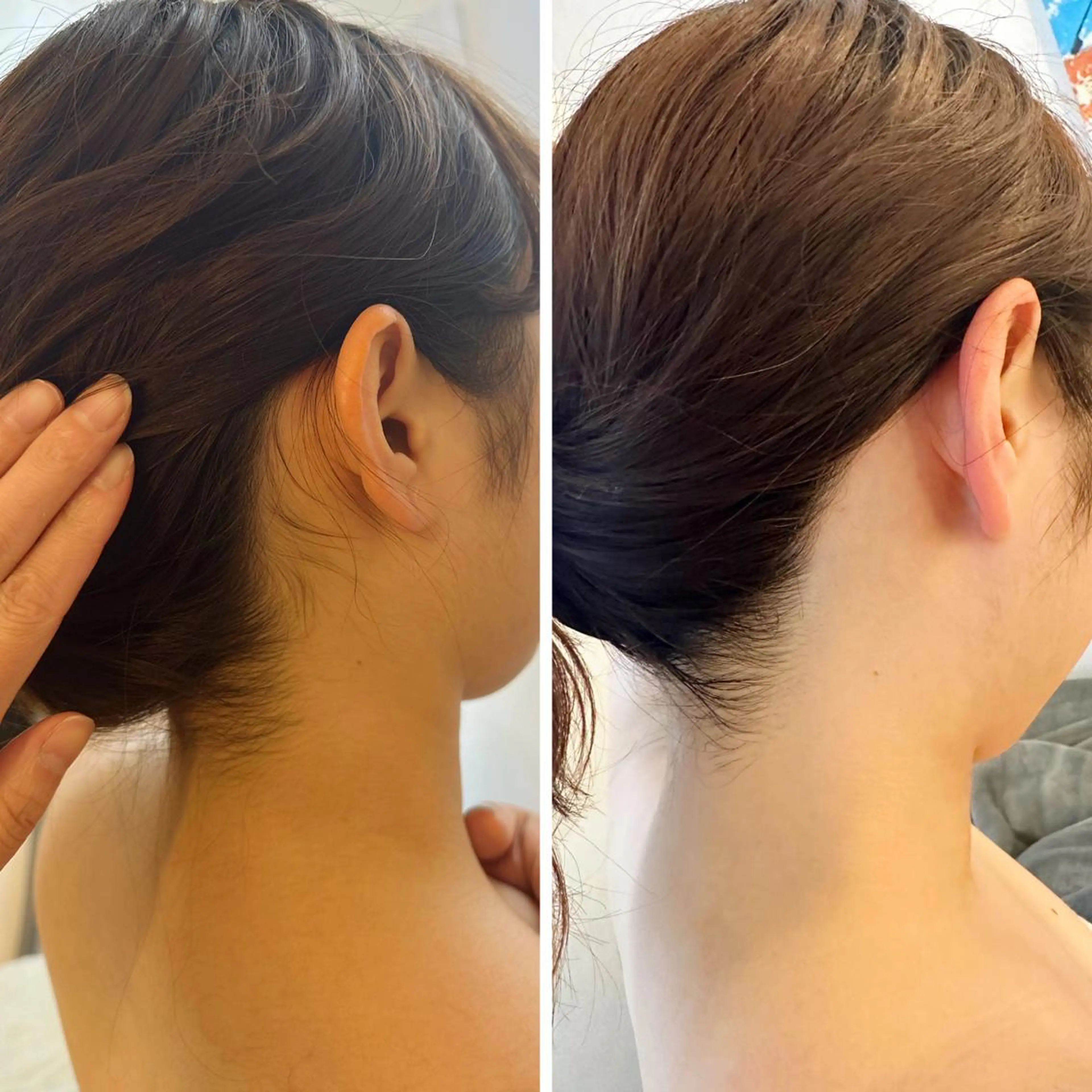 うなじ脱毛/美肌脱毛 LABELのエステ・リラクイメージ