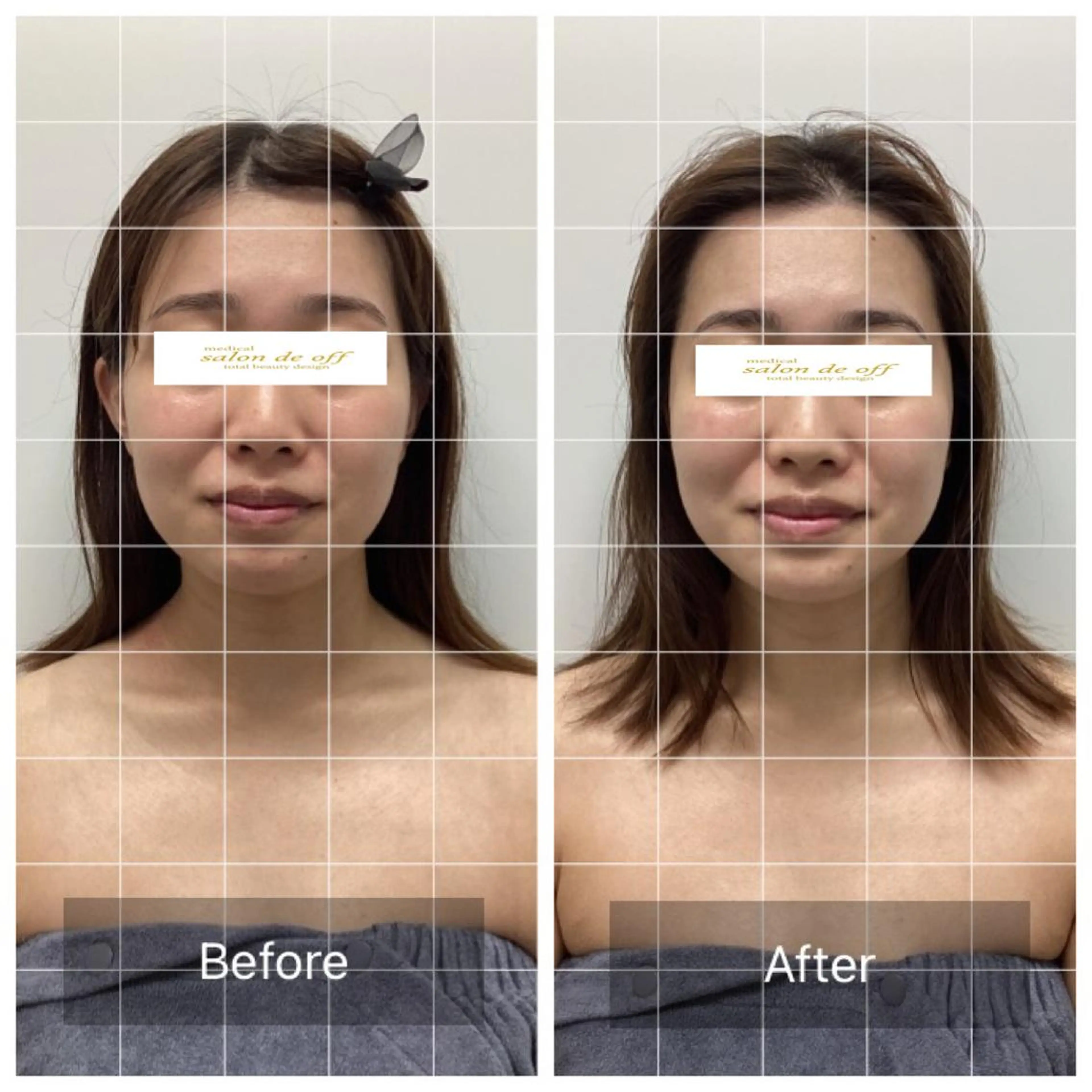 メディカルサロンドオフ所属・ハリサロンドオフ 美容鍼灸×小顔整体のエステ・リラクイメージ