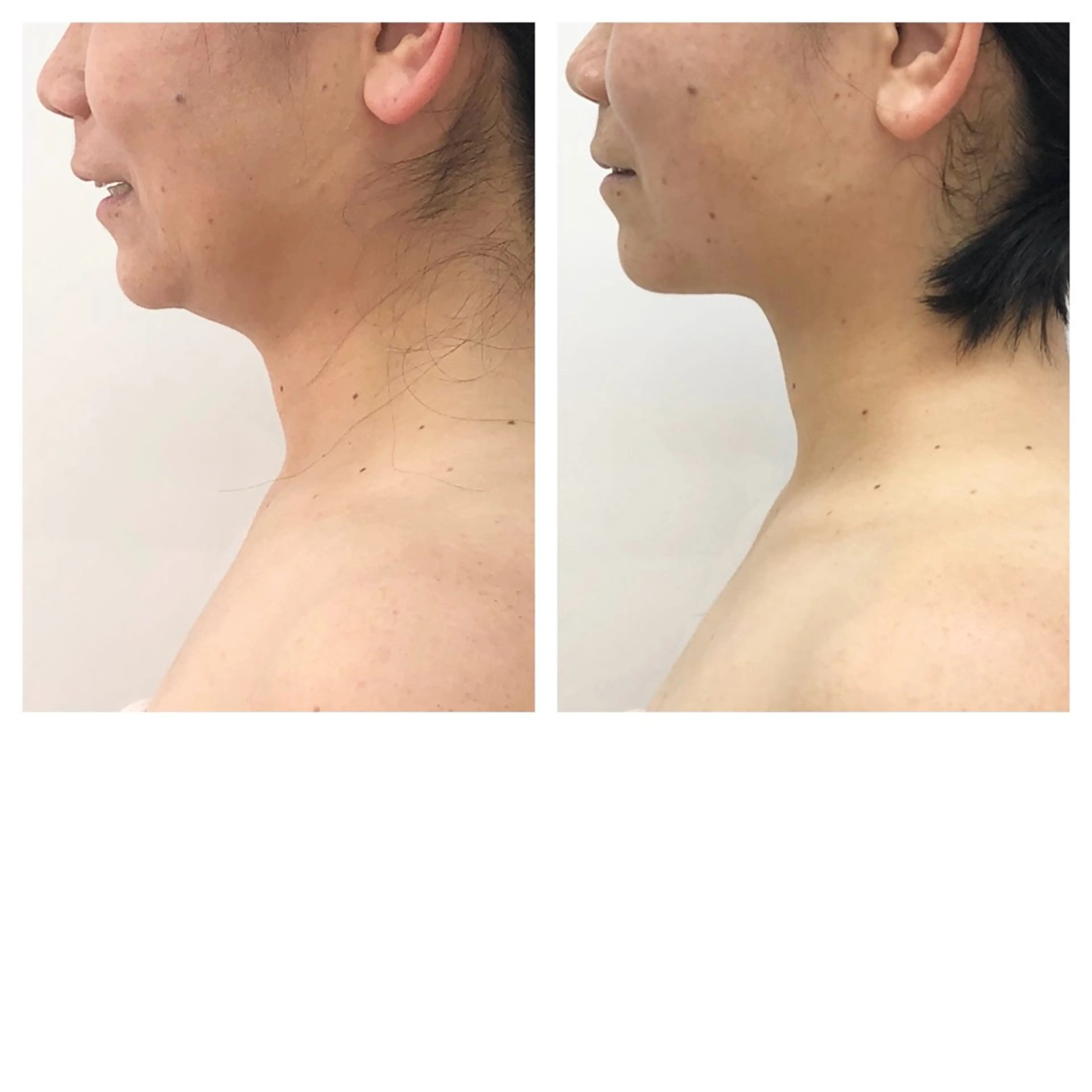 エステサロンhana 加納ゆかのエステ・リラクイメージ