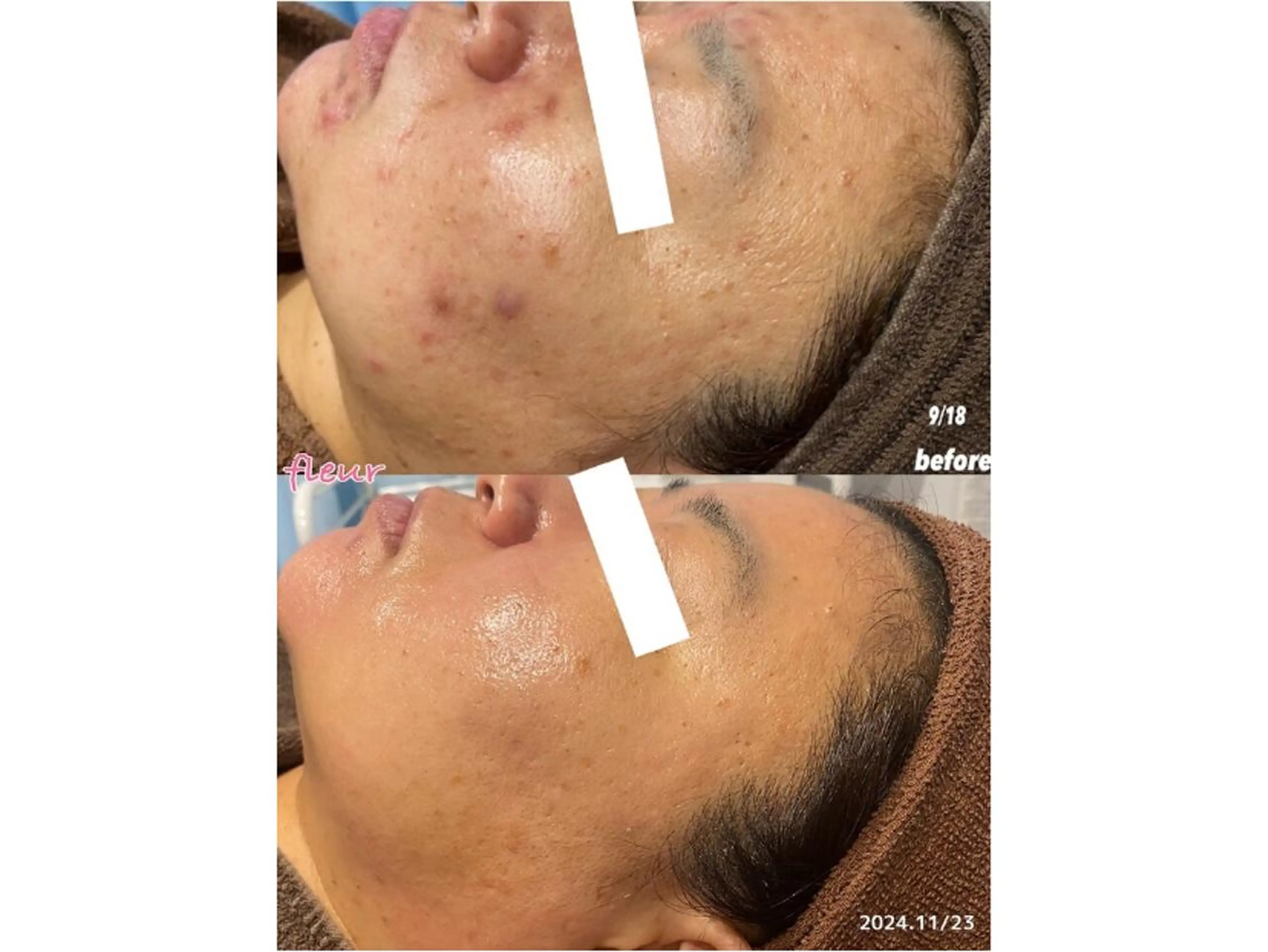 Fleur フルールのエステ・リラクイメージ