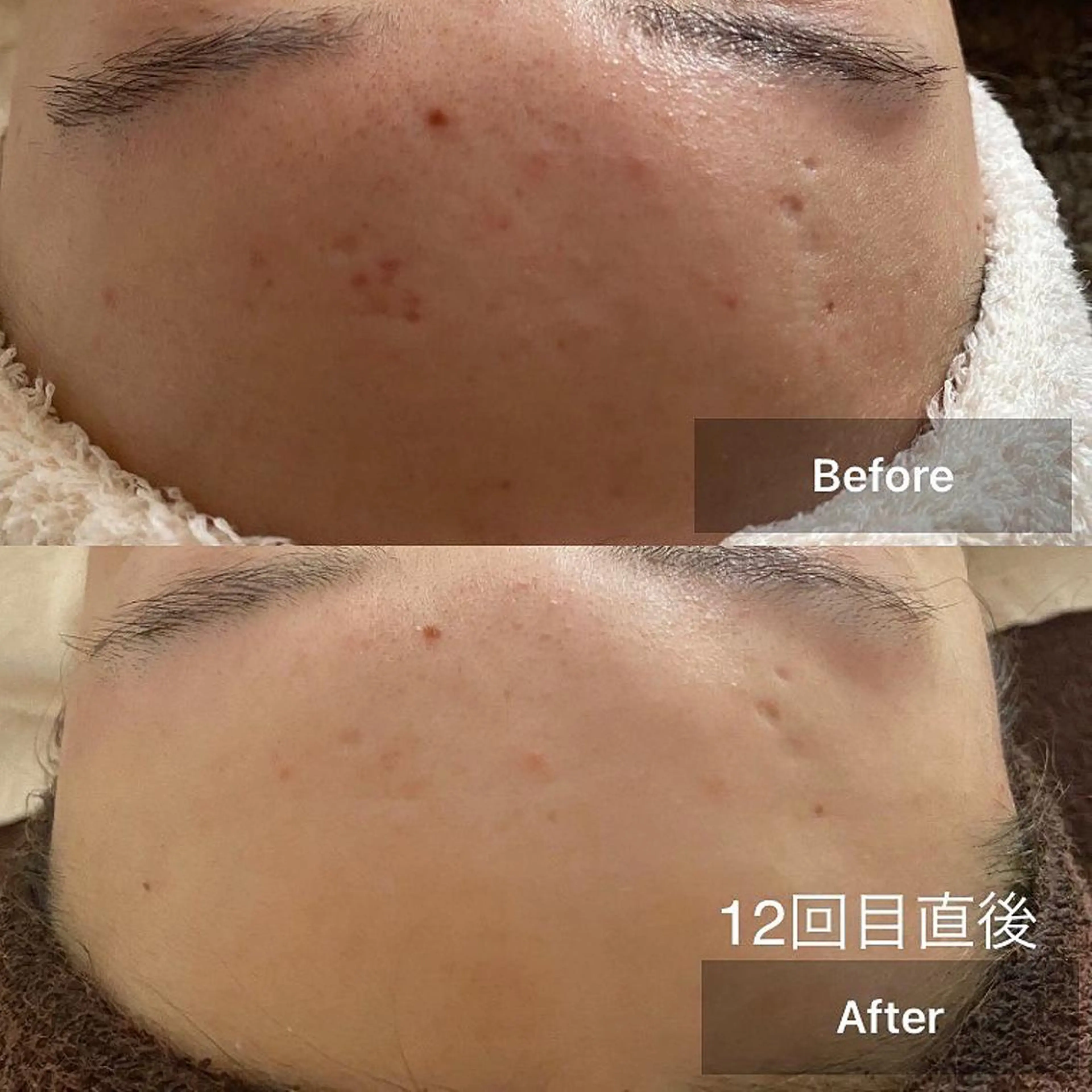 美肌・リラクゼーションサロンLu,Mie所属・美肌と癒しのサロン Lu,Mieのエステ・リラクイメージ