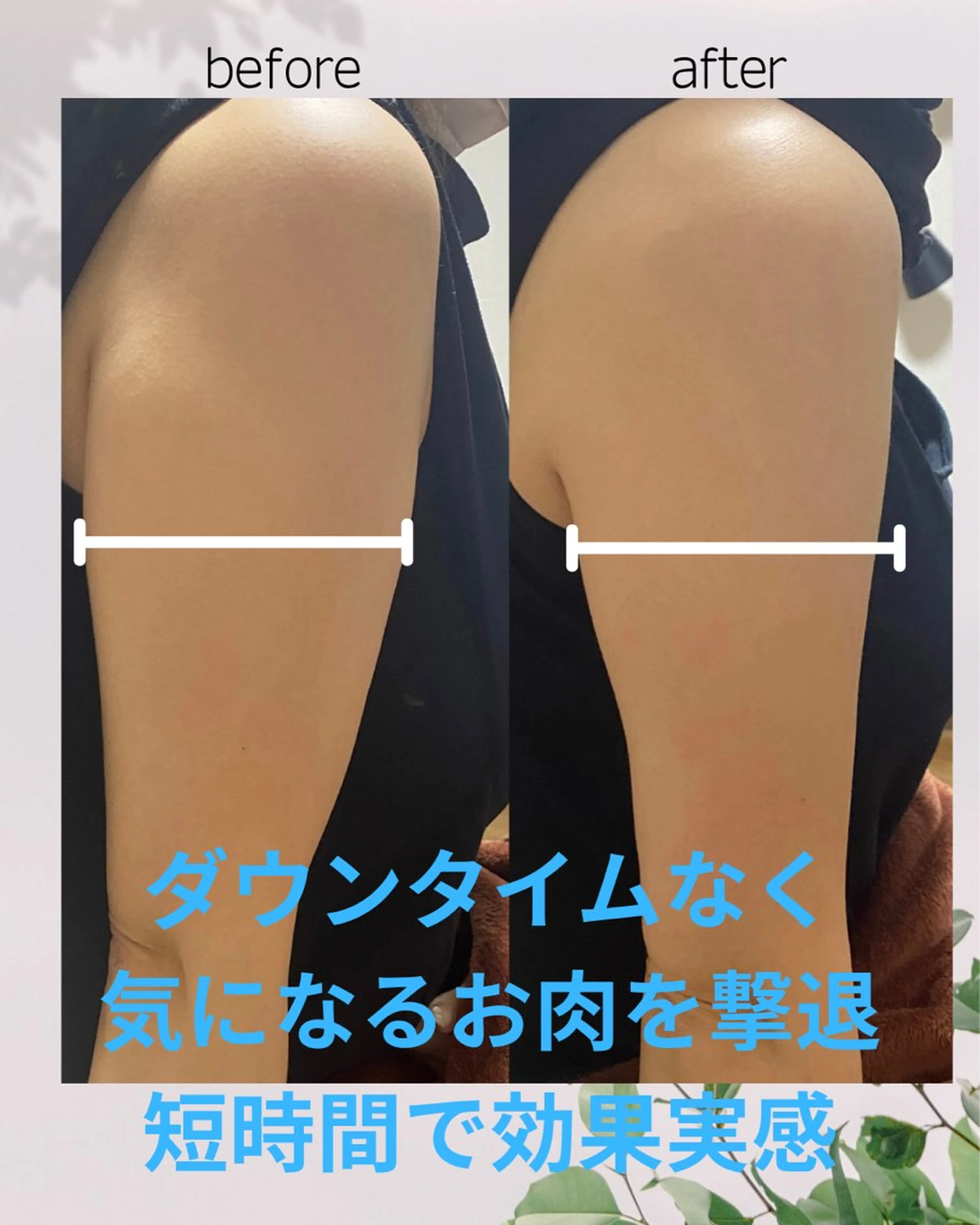 【短時間で二の腕スッキリ】ふりそで肉撃退レッドショット¥15000の写真