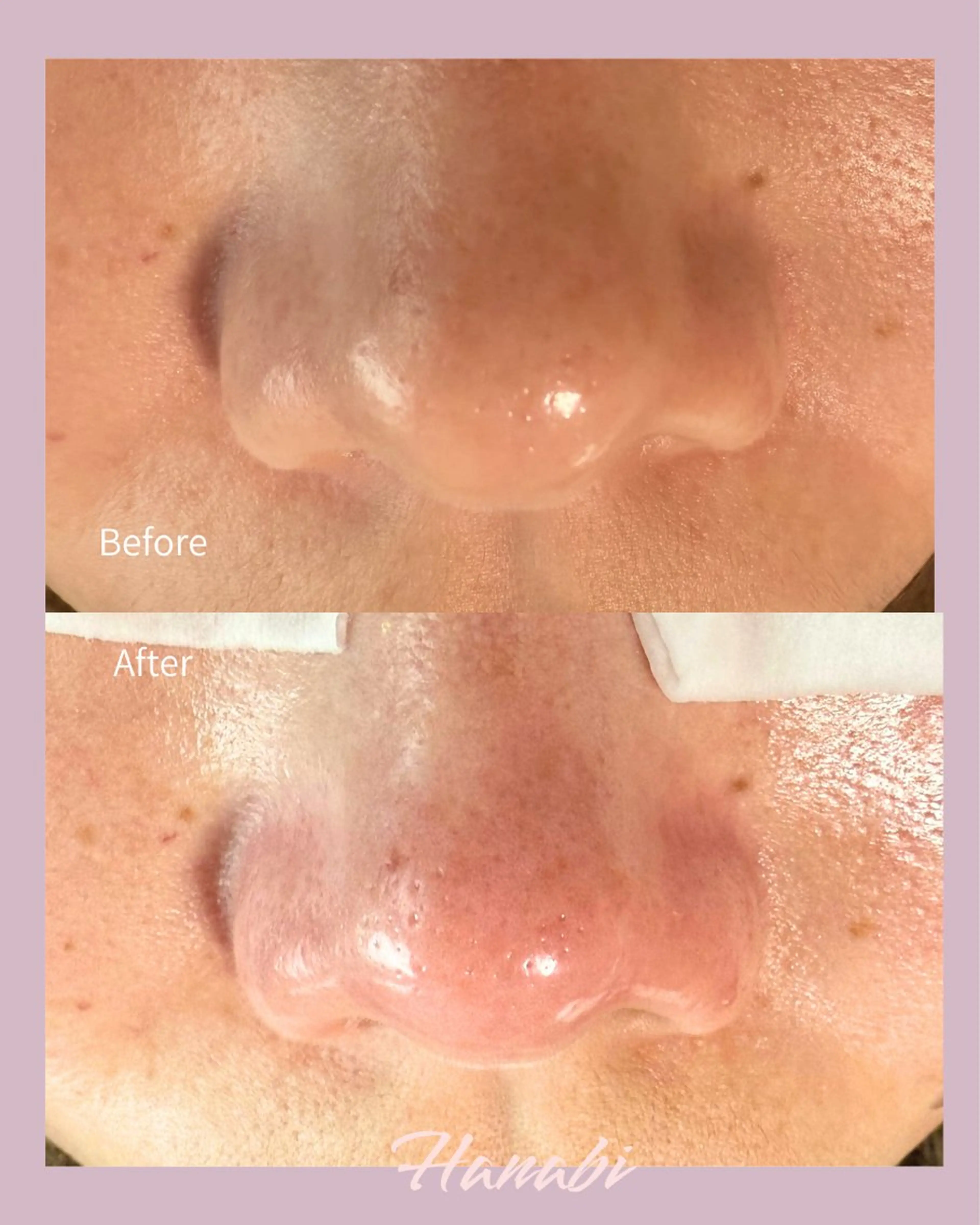 エステ 毛穴専門サロン Hanabiのエステ・リラクイメージ