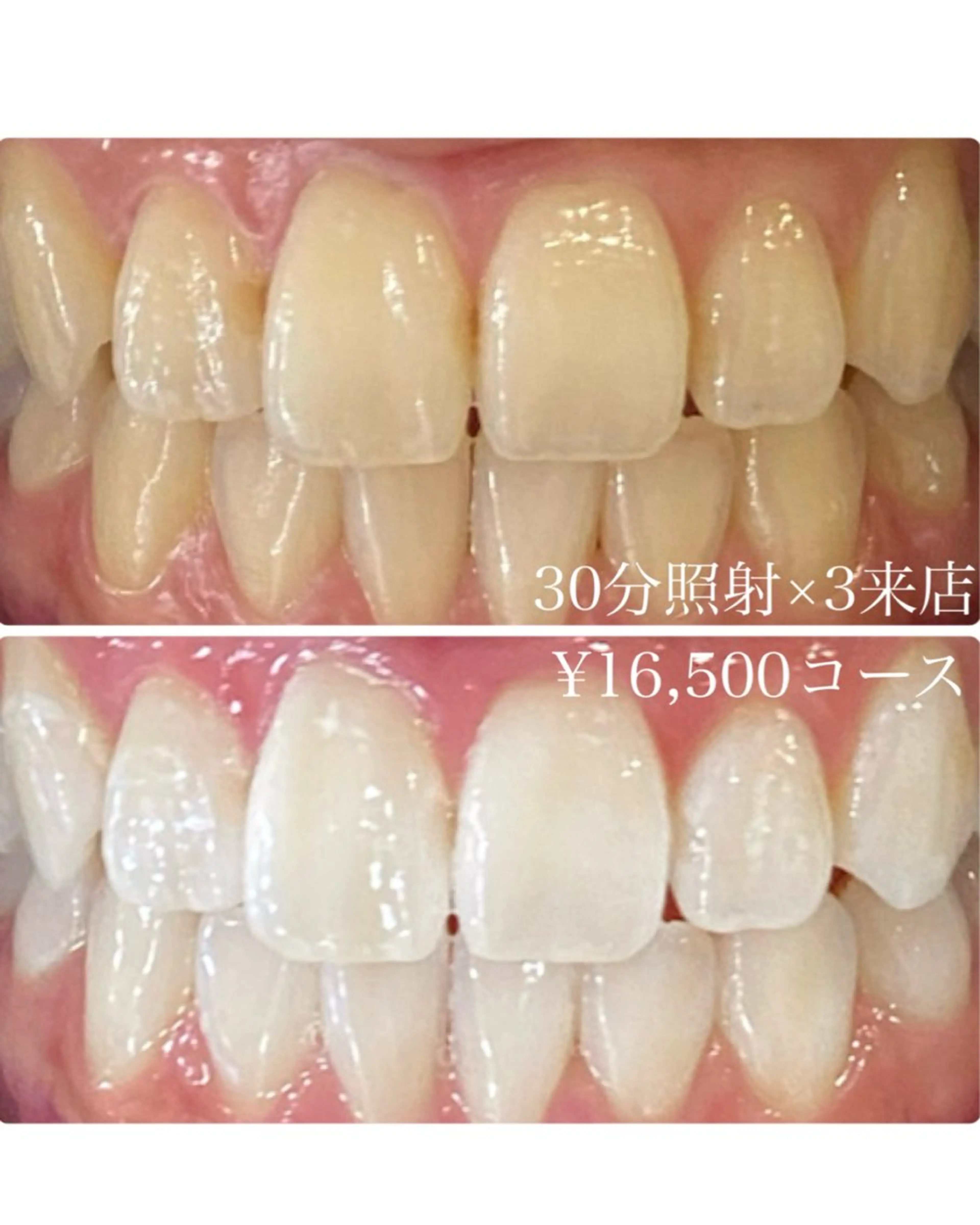 メンズ その他 ホワイトニングルーム　川崎店所属・ホワイトニング ルーム　川崎店のその他イメージ