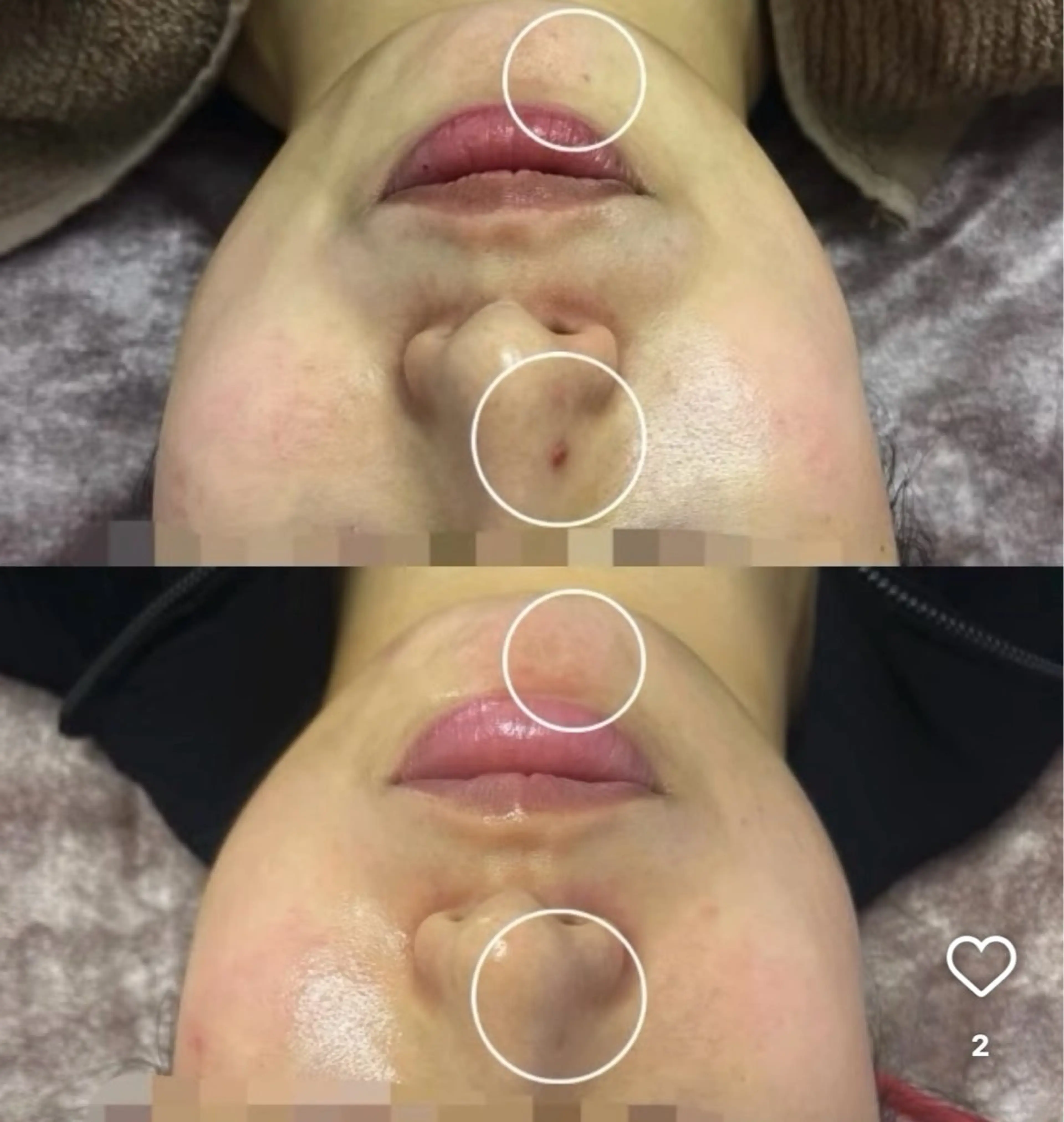 美肌・小顔専門🪄 看護師施術/松﨑のエステ・リラクイメージ