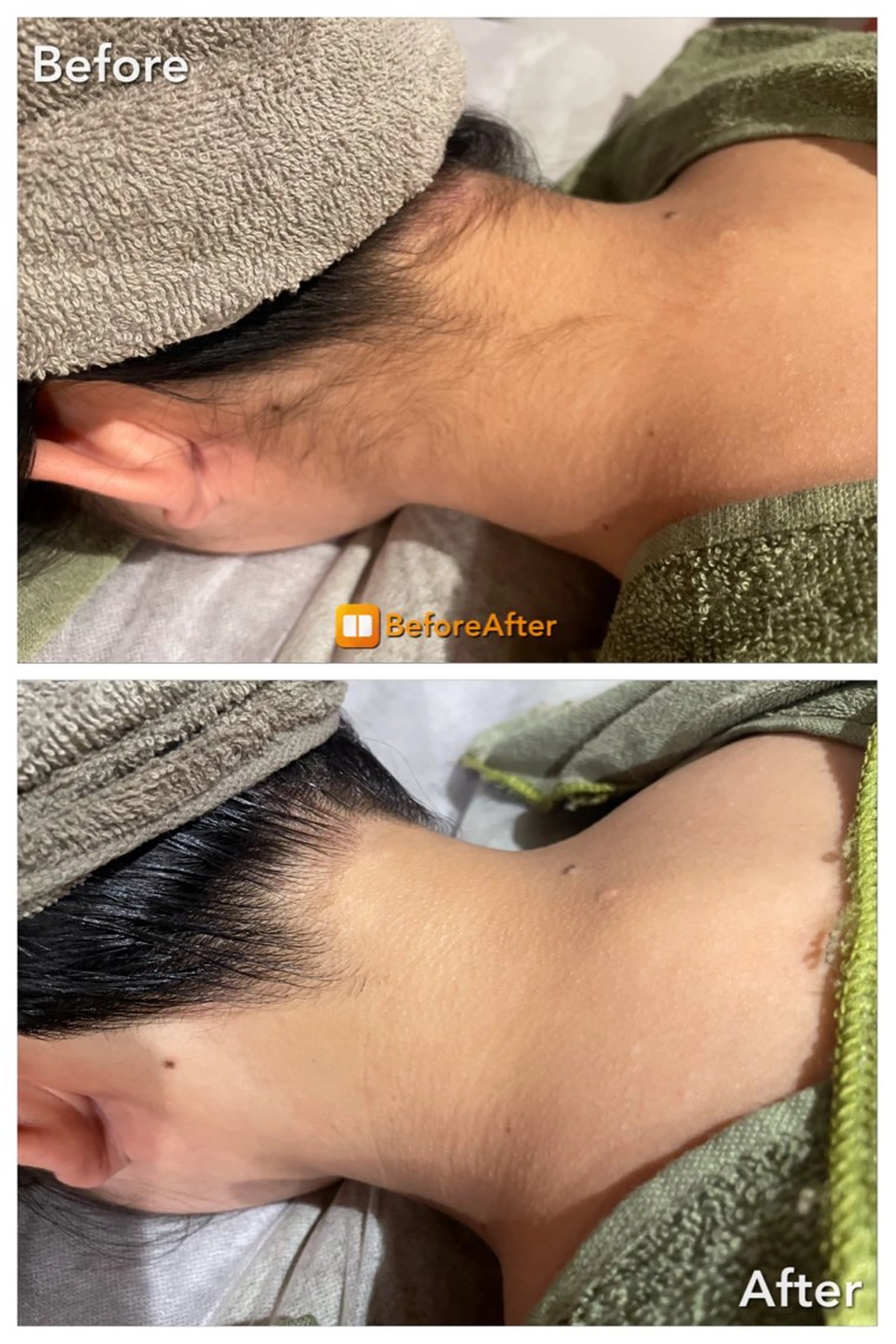 Meupニキビ専門店 背中/ハーブ/肌管理のその他イメージ