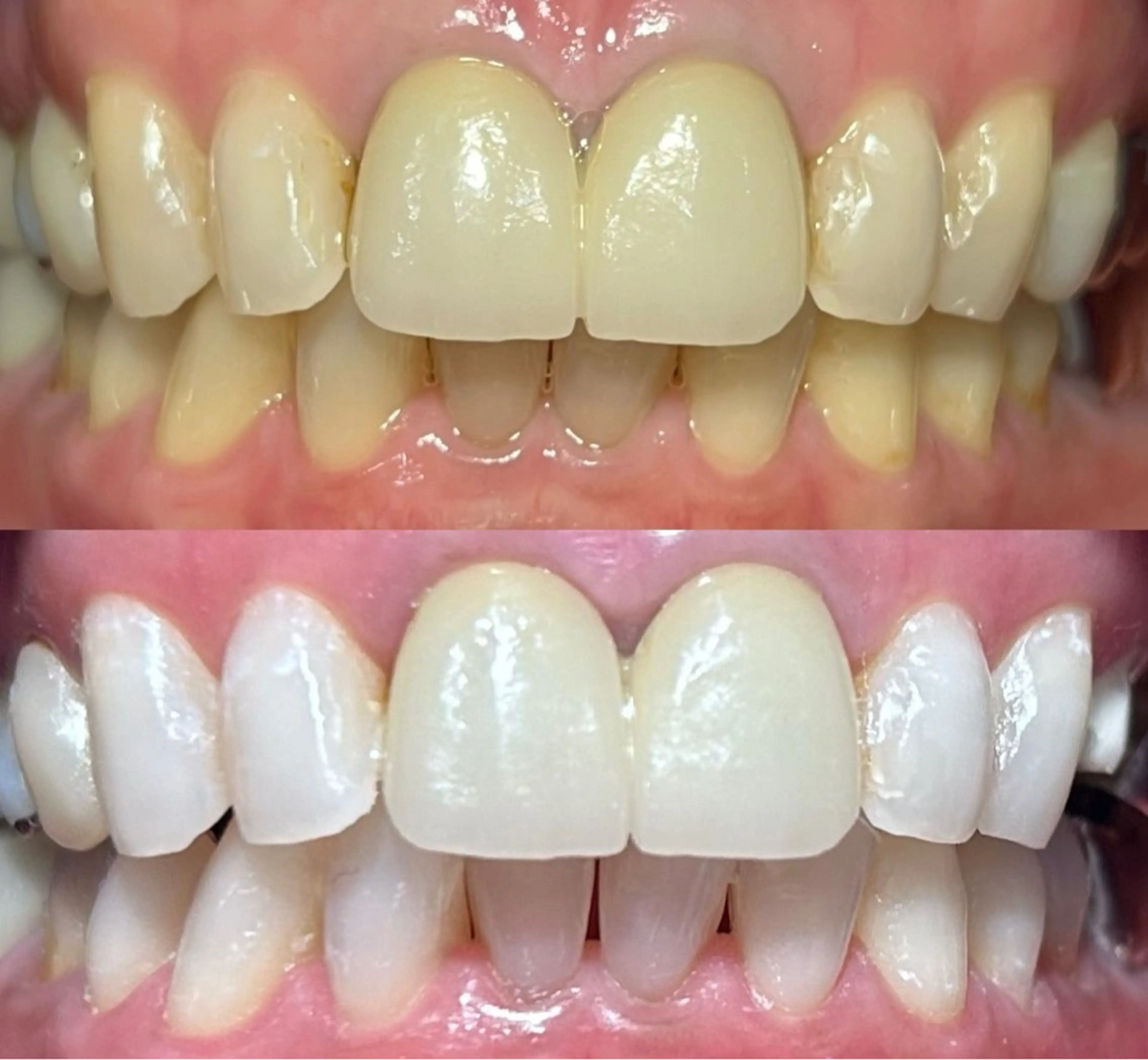 io teeth careのその他イメージ