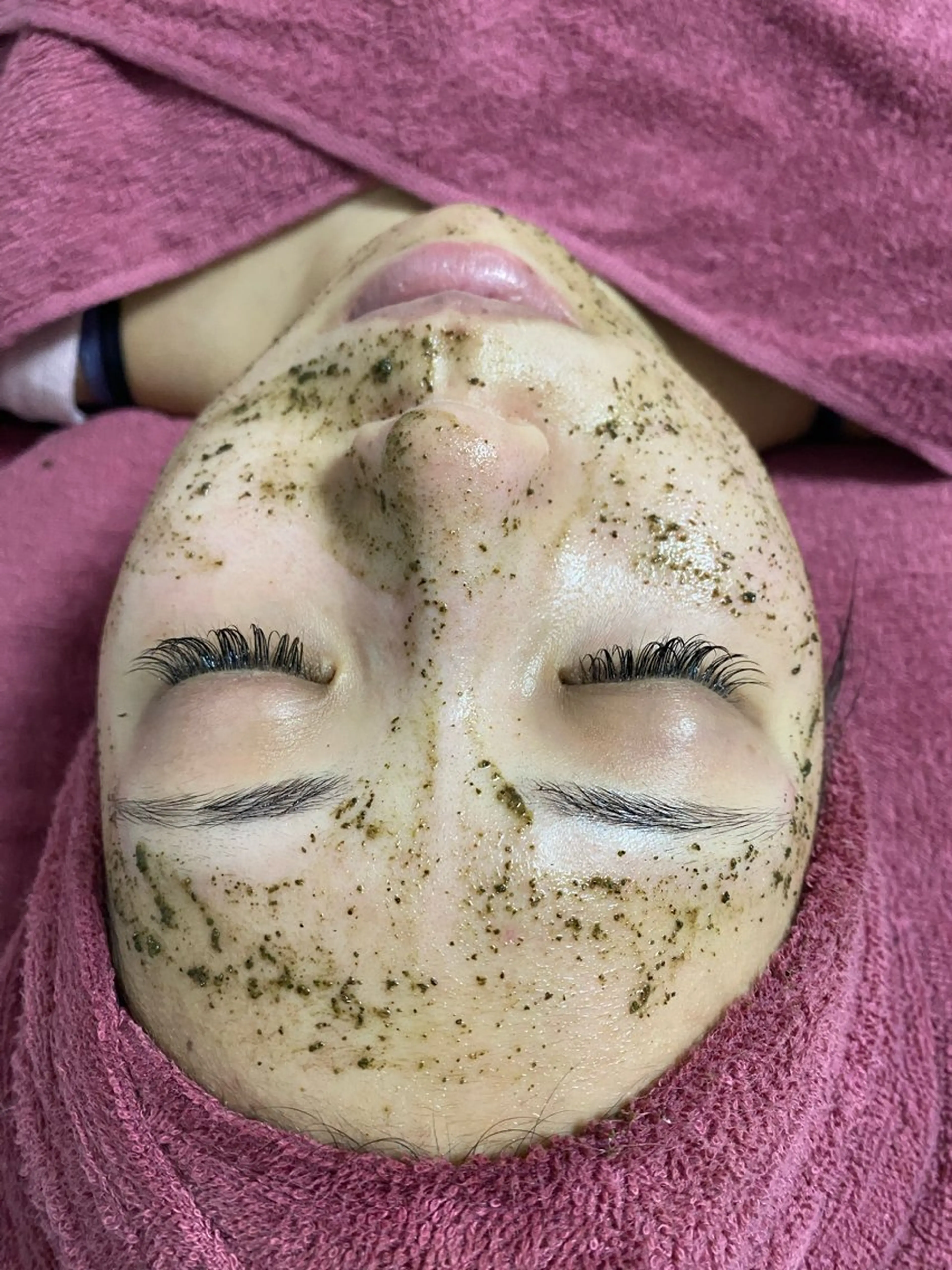 エステ Chalon所属・REVI取扱・肌悩み 毛穴Chalonのエステ・リラクイメージ