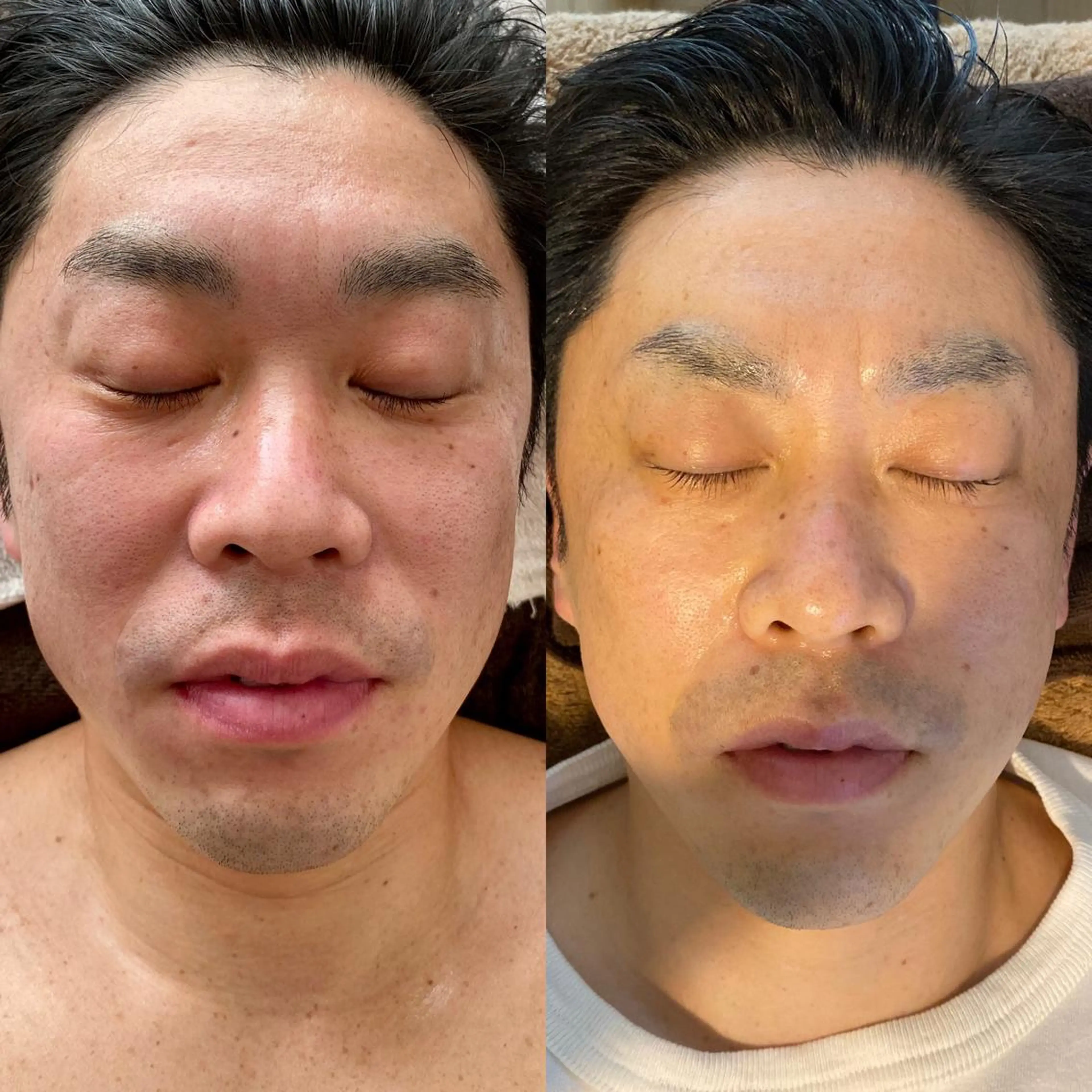 Meetite 小林のエステ・リラクイメージ