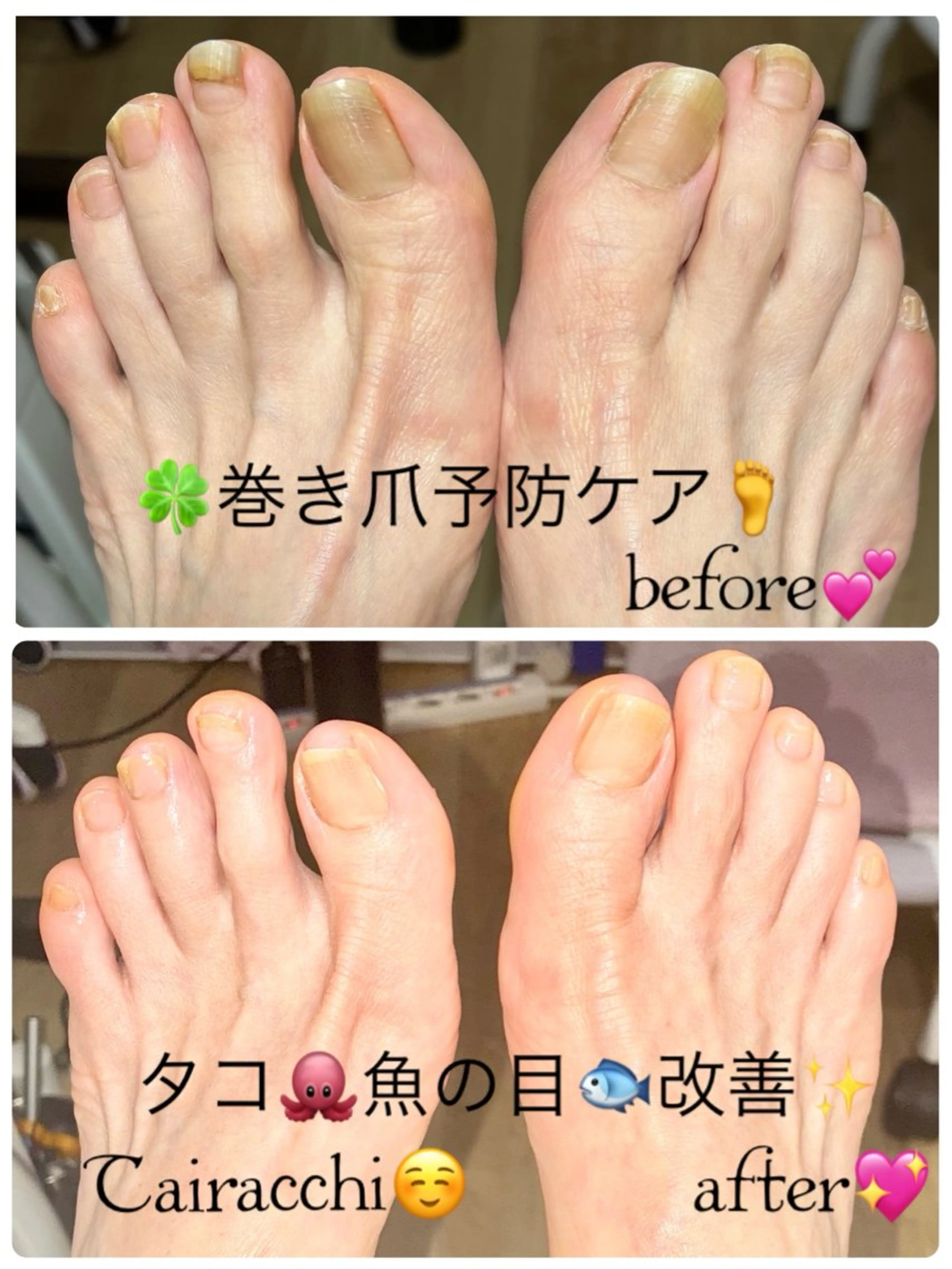 ネイル フットネイル フットネイル Tairacchi ﾀｲﾗｯﾁのエステ・リラクイメージ