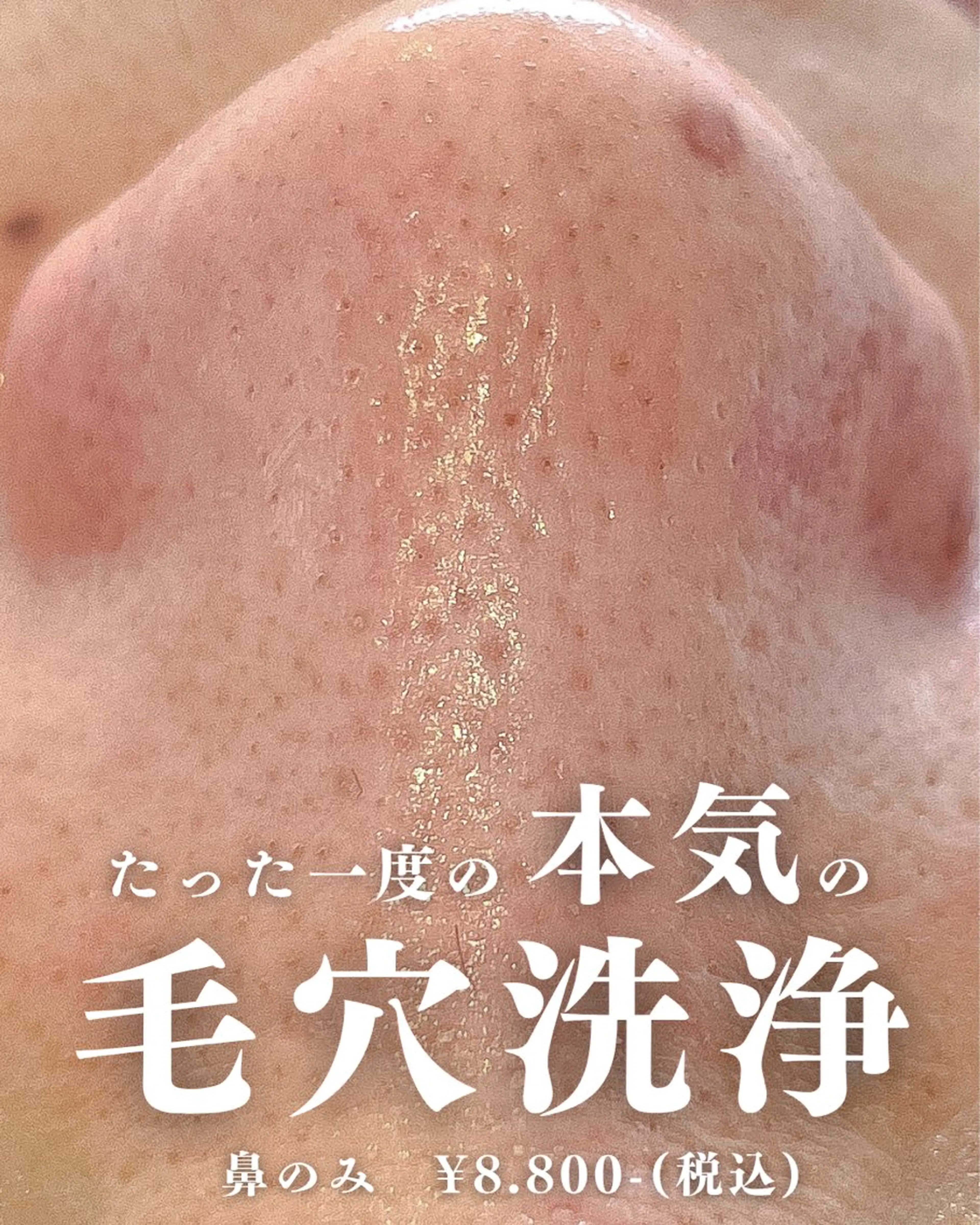 エステ La・Bellvie所属・La･Bellvie 【星ヶ丘店]のエステ・リラクイメージ