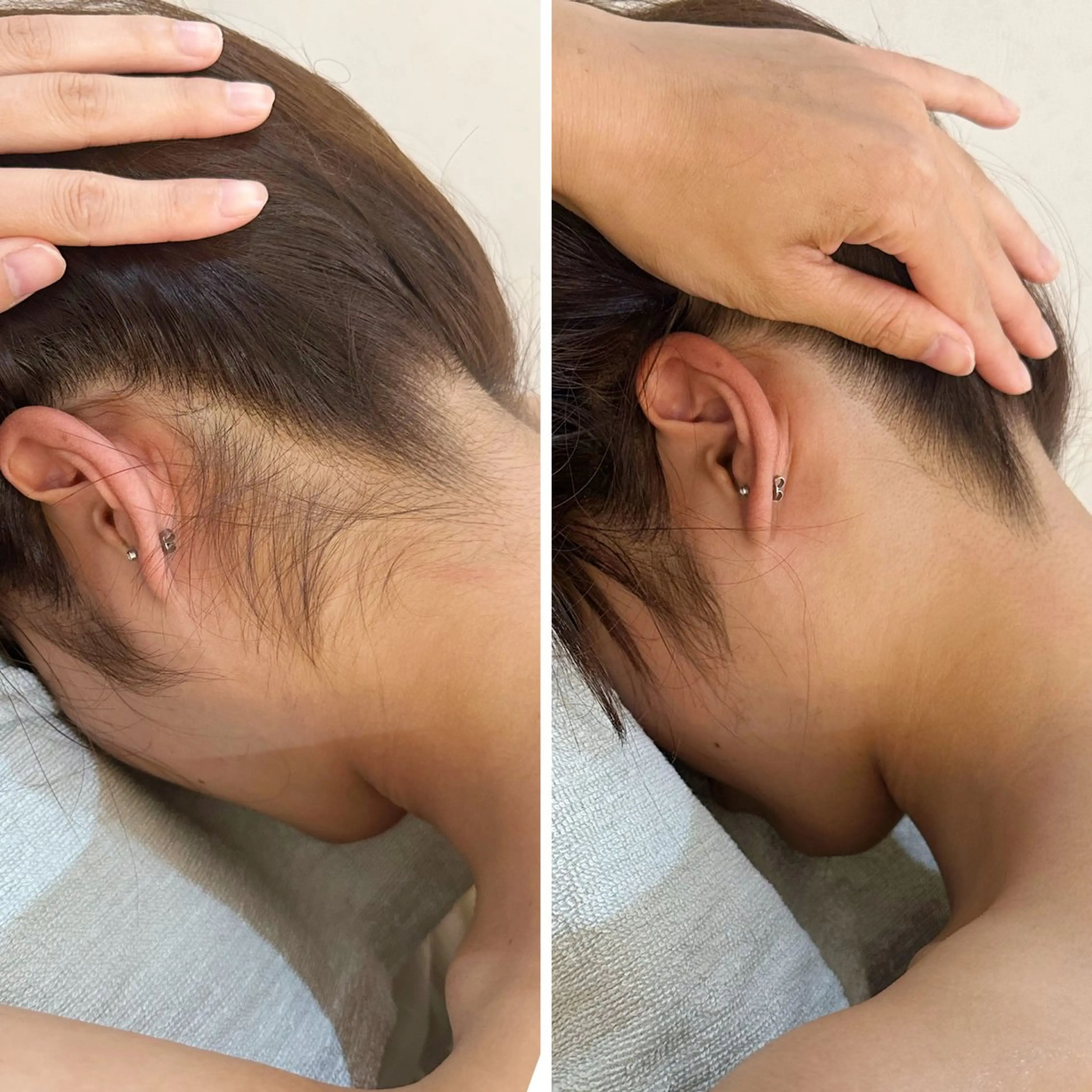 うなじ脱毛/美肌脱毛 LABELのエステ・リラクイメージ