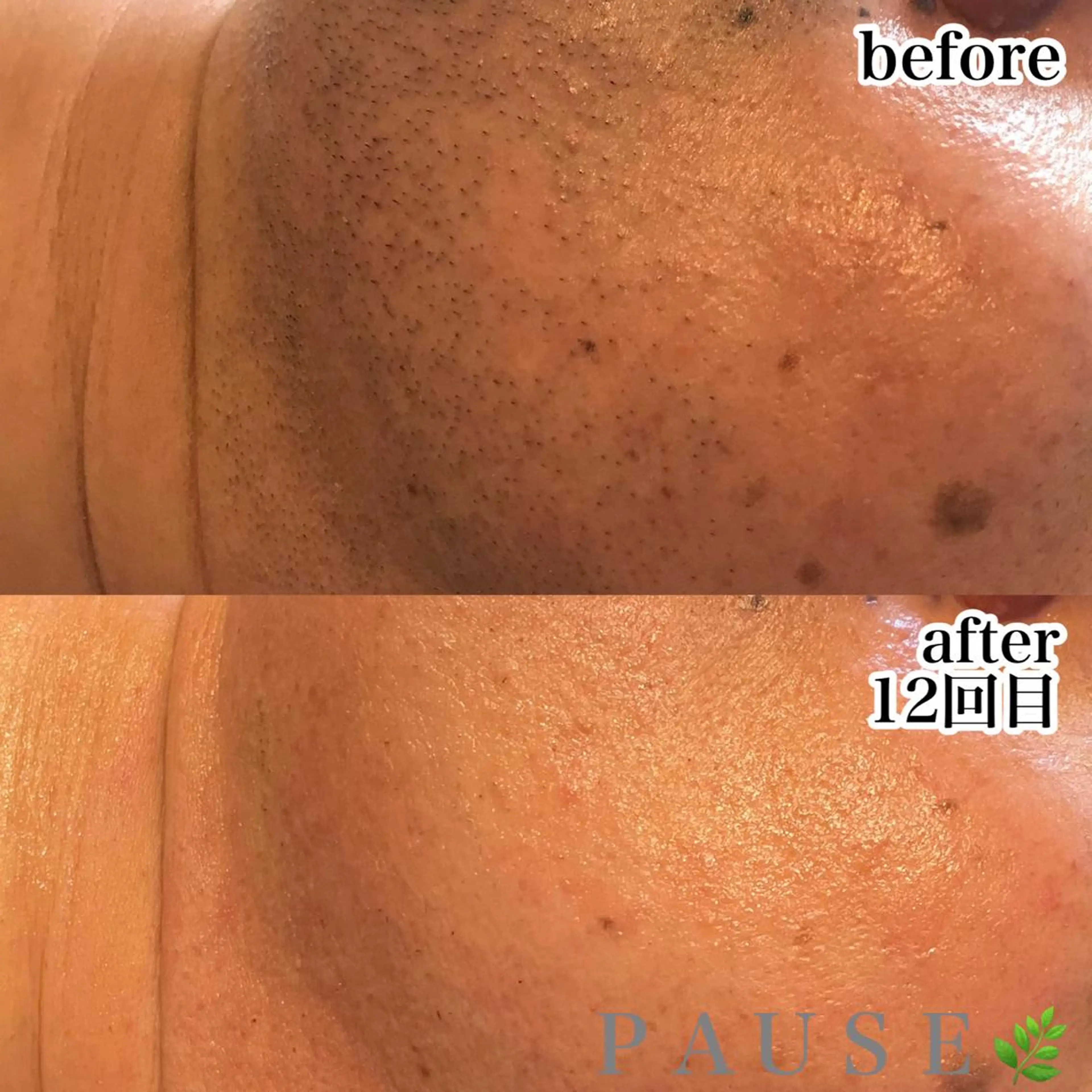 脱毛 浜野 恵美のエステ・リラクイメージ