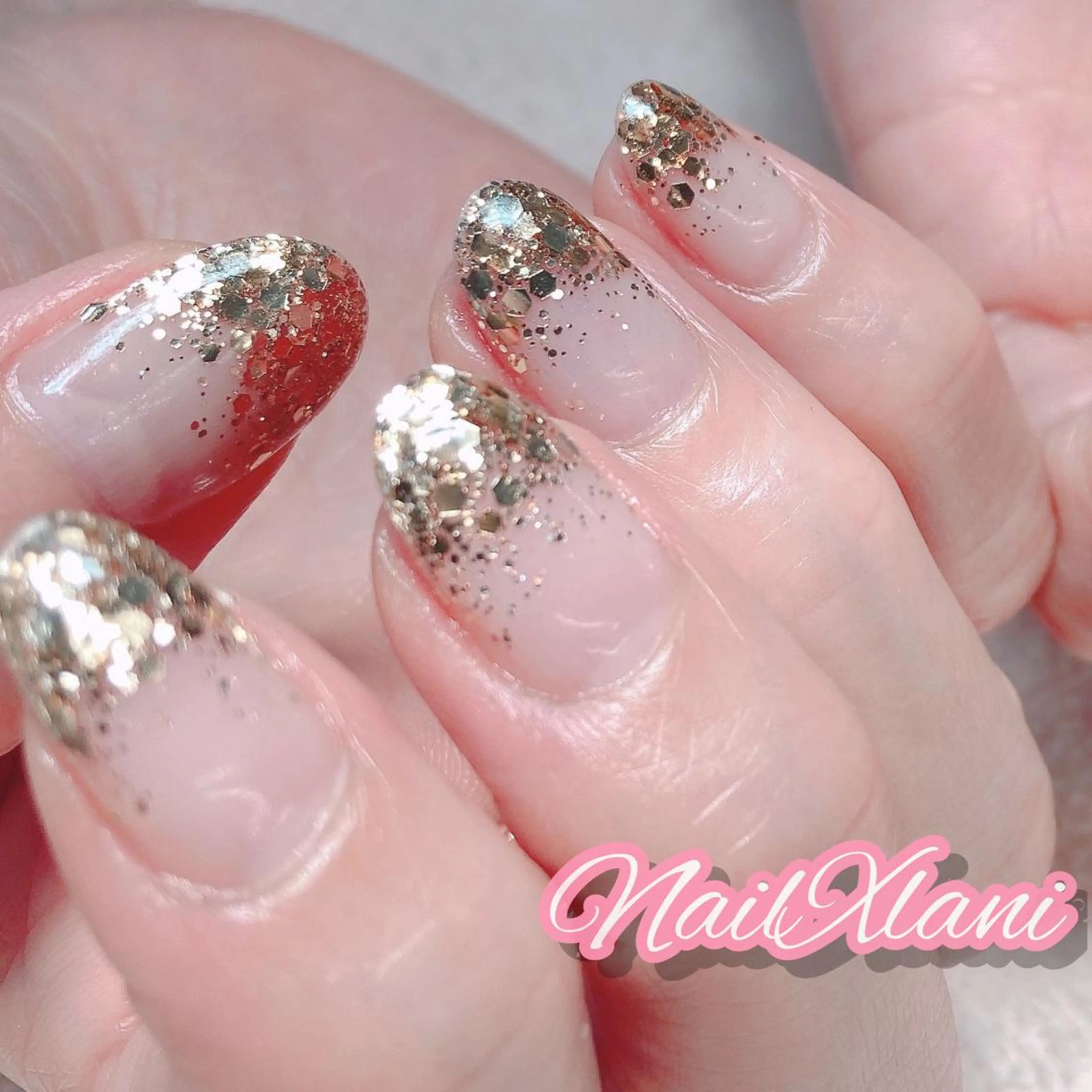 ネイル Nail×Lani 深爪矯正対応◎のネイルデザイン