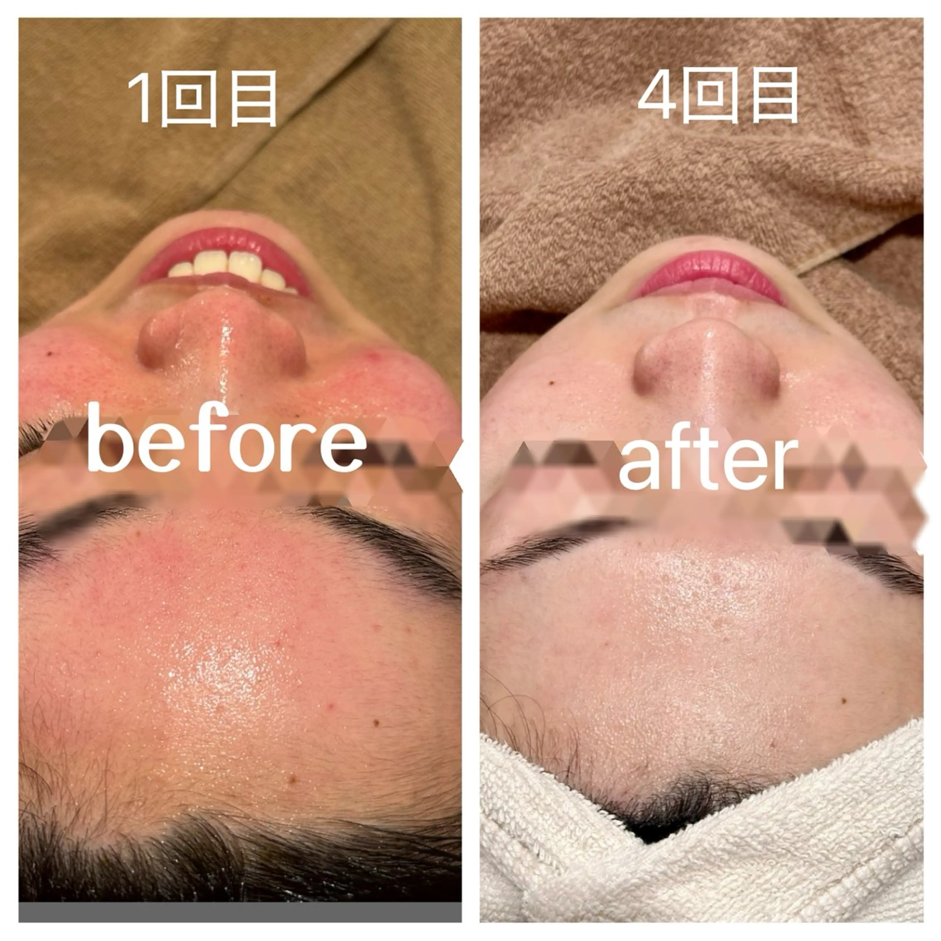 エステ ANERA Second所属・尾上 沙織のエステ・リラクイメージ