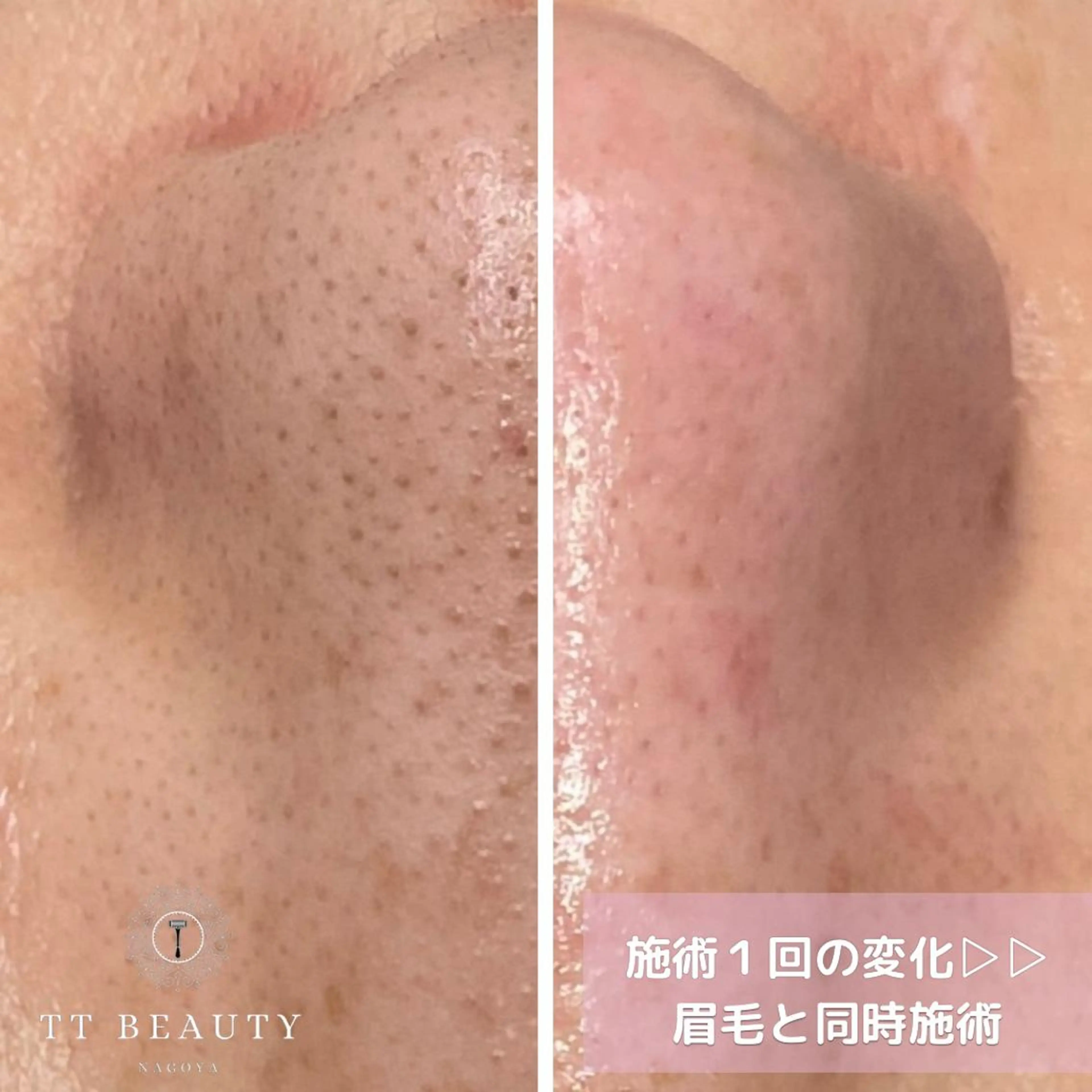 アイブロウ TT Beauty所属・TT Beautyの眉毛・アイブロウイメージ