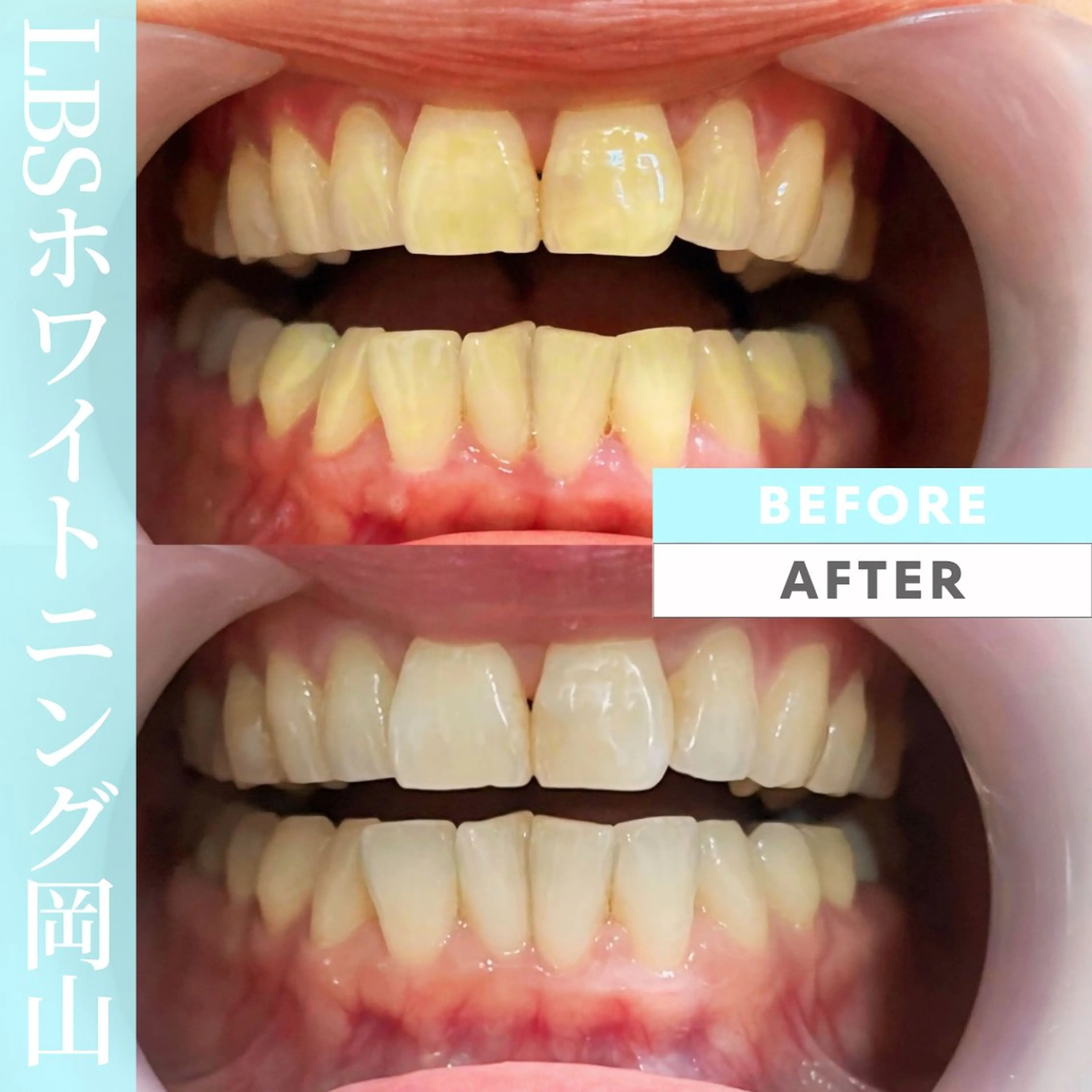 LBSホワイトニング 🌐岡山店のその他イメージ