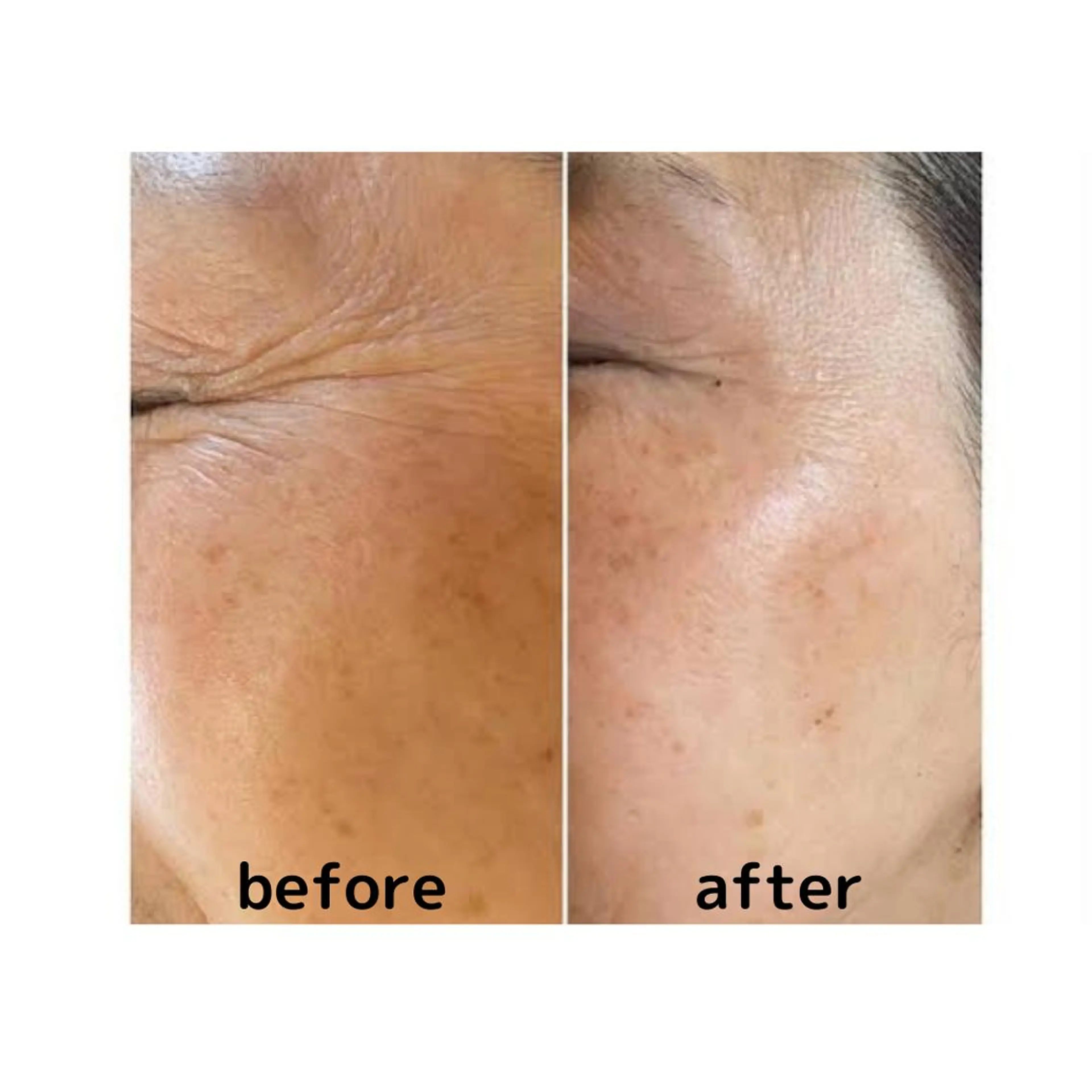 エステ aimee　肌質改善サロン【アイミー】所属・肌質改善サロン aimee｜アイミーのエステ・リラクイメージ