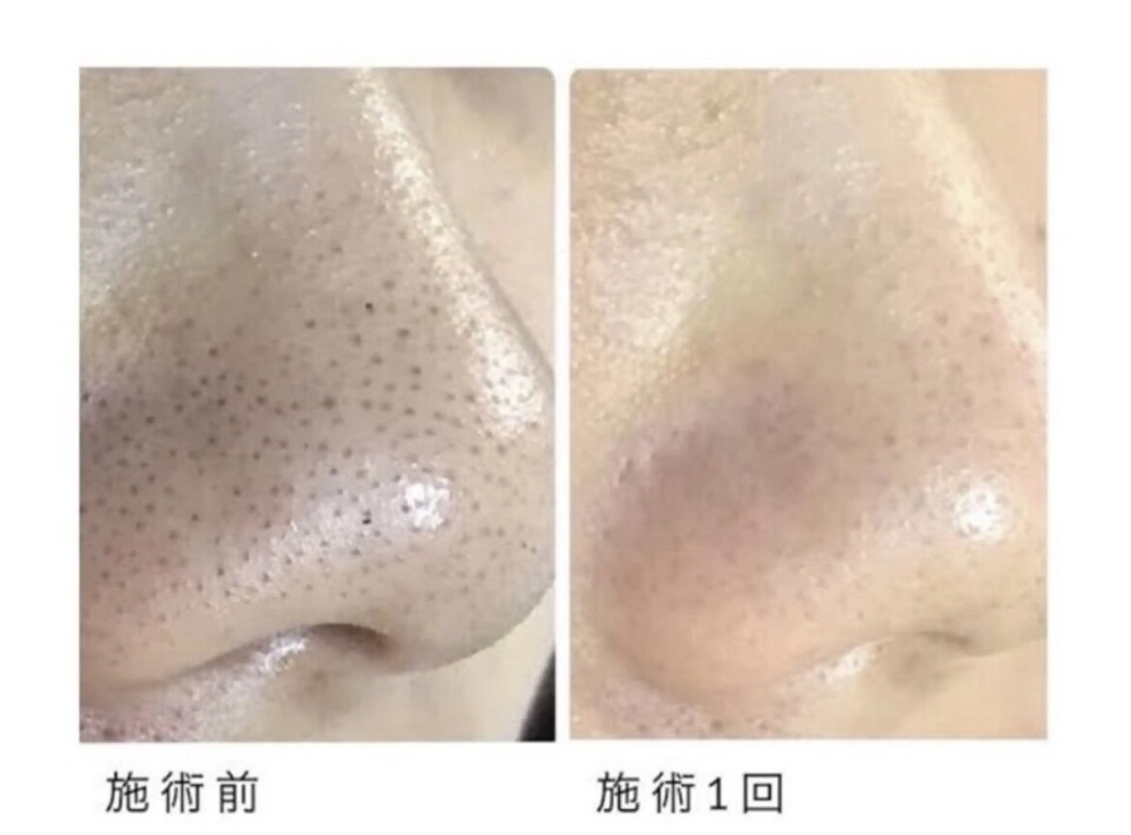 脱毛サロンALGO所属・美肌脱毛/ワックス ALGO高槻店のエステ・リラクイメージ