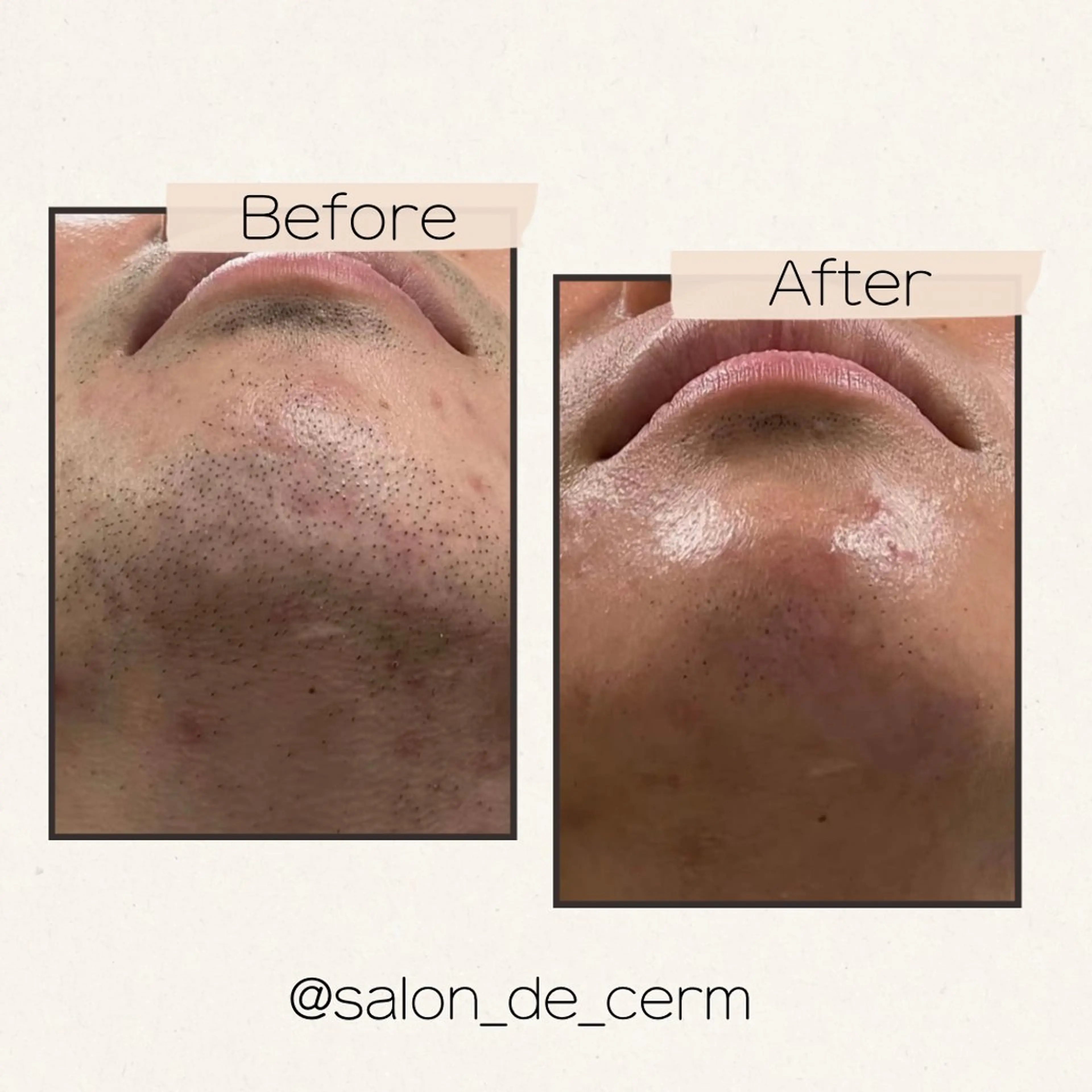 脱毛 salon de cerm所属・CERM/心斎橋眉毛 /心斎橋HBLの眉毛・アイブロウイメージ