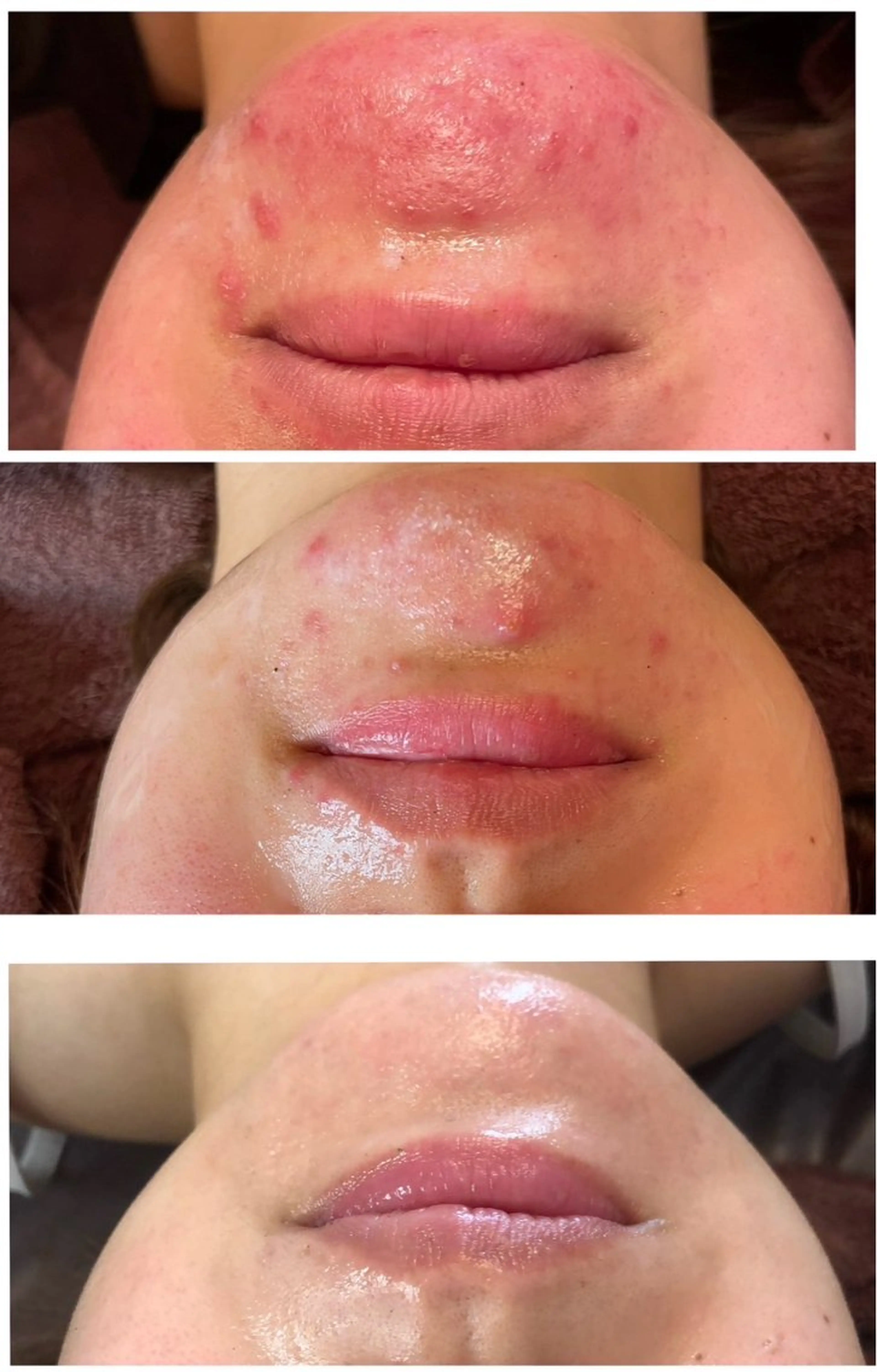 エステ Lei beauty salon所属・松ヤニワックス専門/ 梅田/Leiのエステ・リラクイメージ