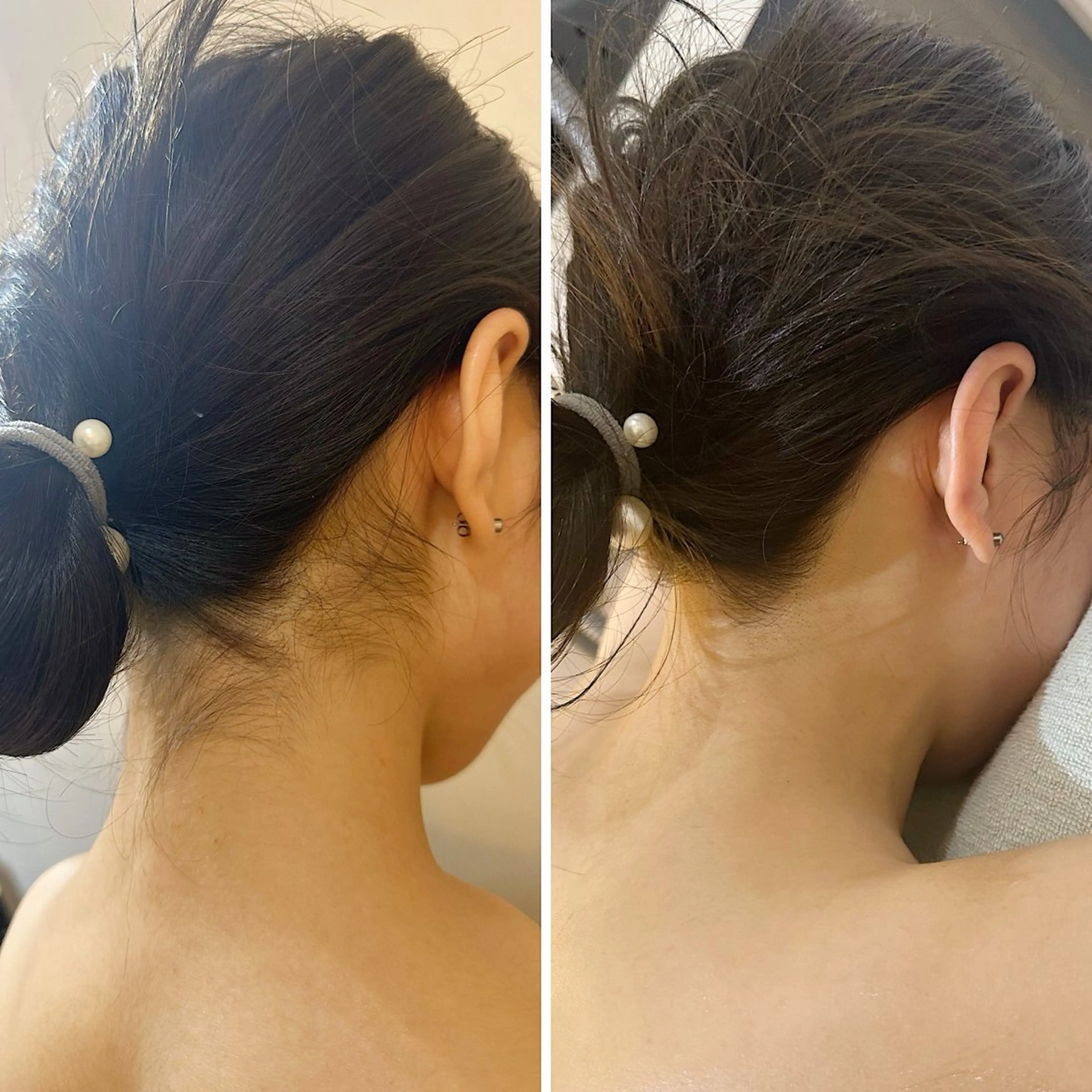 脱毛 うなじ脱毛/美肌脱毛 LABELのエステ・リラクイメージ