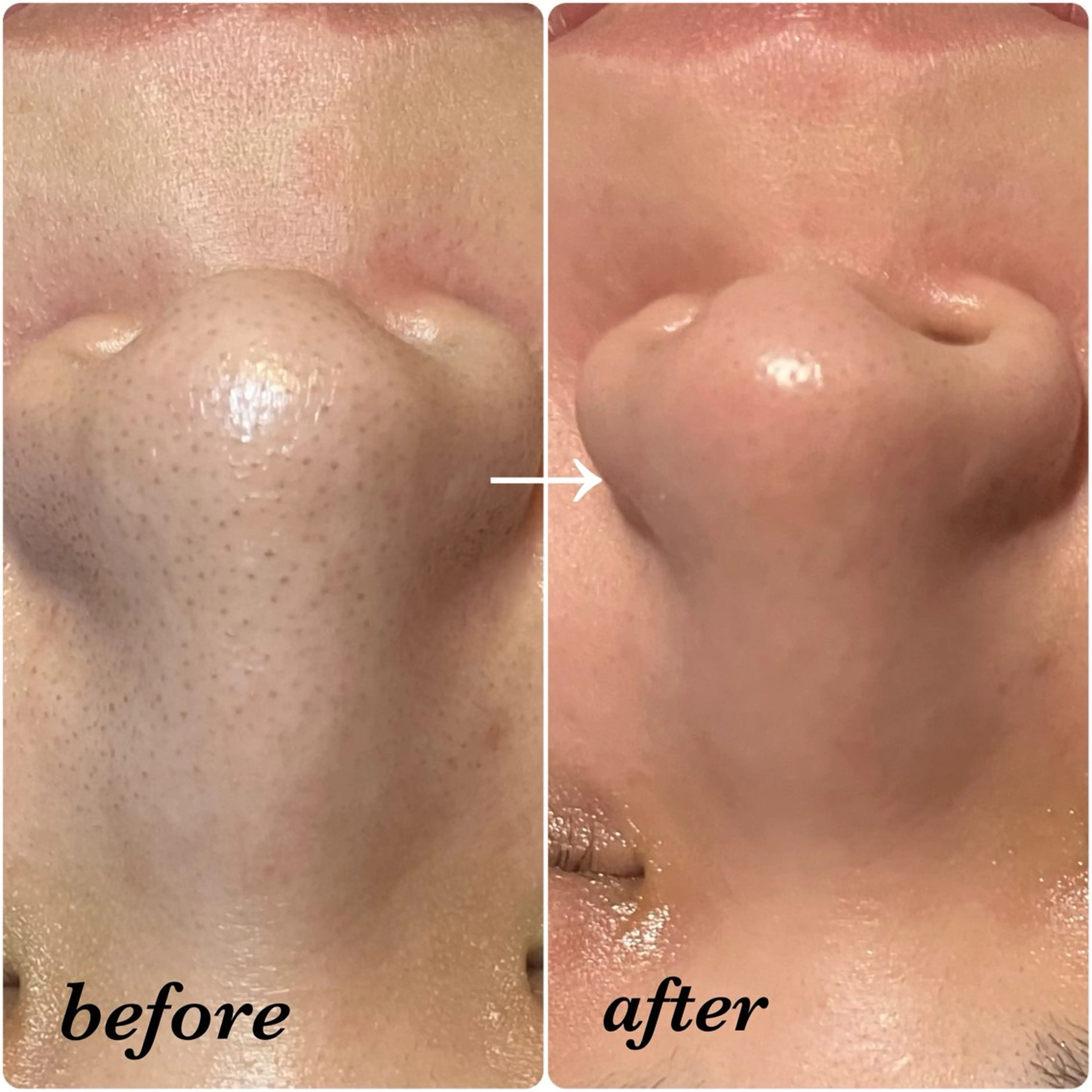 salon akua nail＆リラクのネイルデザイン