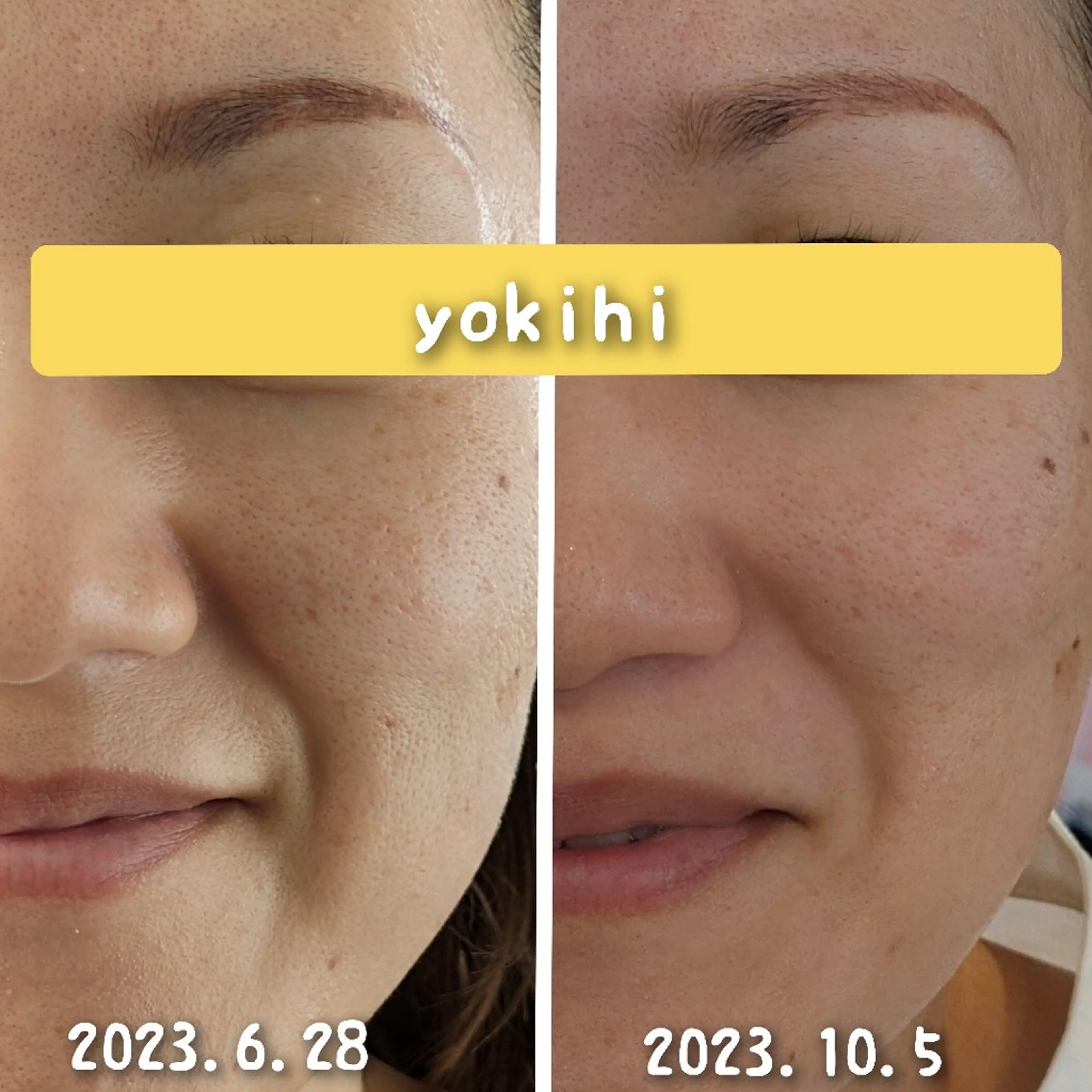 結果が出るスキンケア 肌質改善/まつパのエステ・リラクイメージ