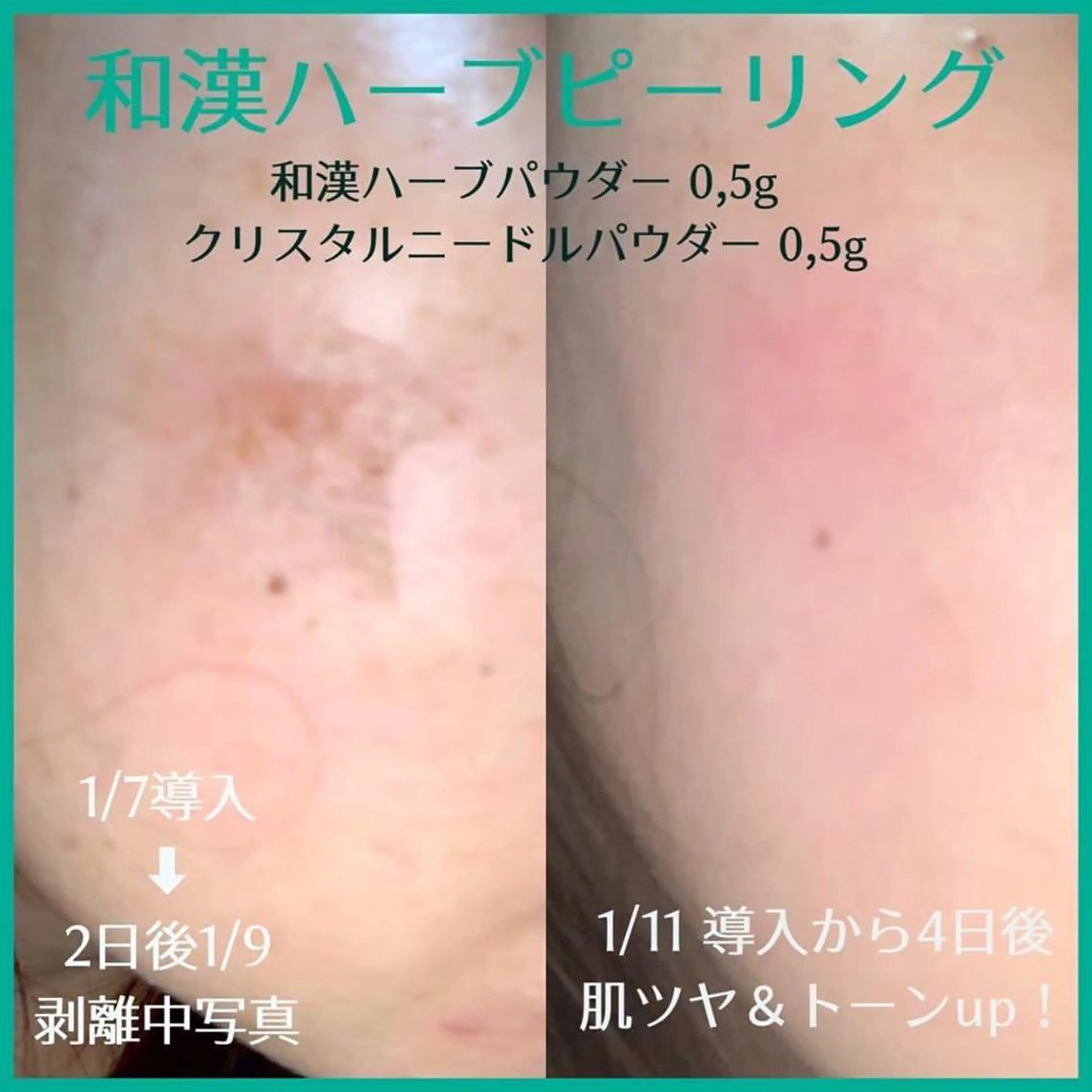 SALON BioBioのエステ・リラクイメージ