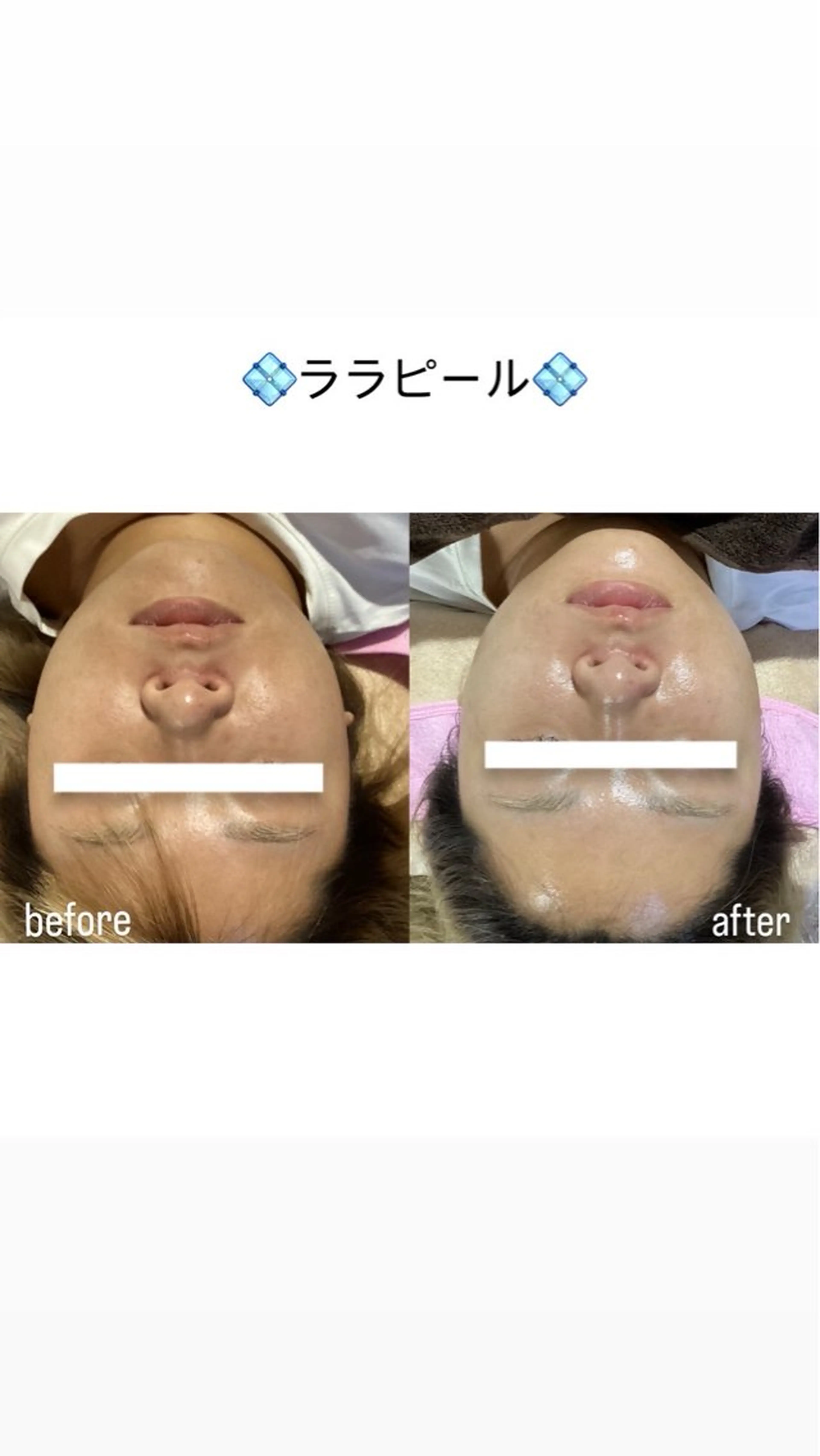 salon merci和泉のエステ・リラクイメージ