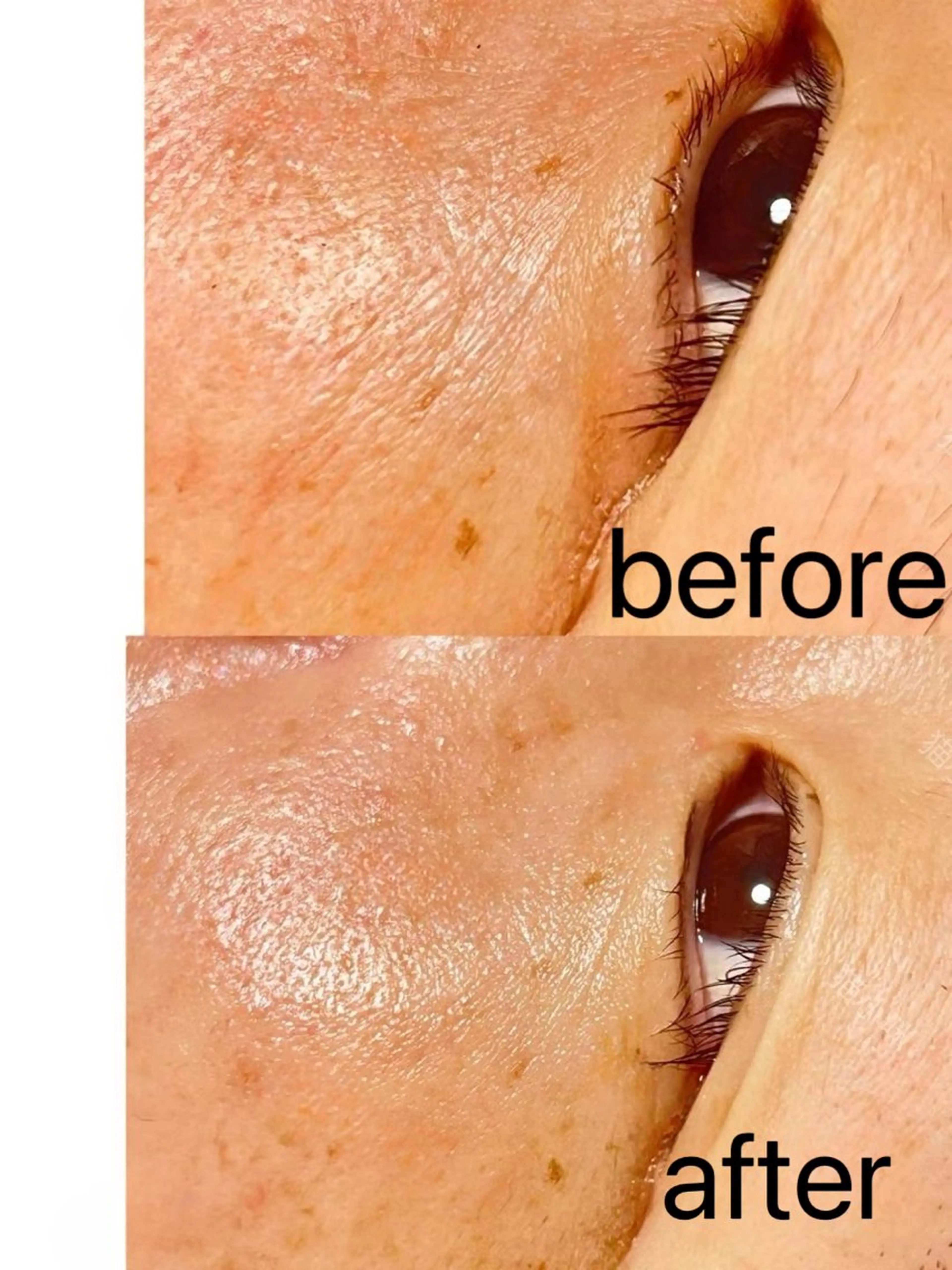 Nature Souce毛穴専門店のその他イメージ