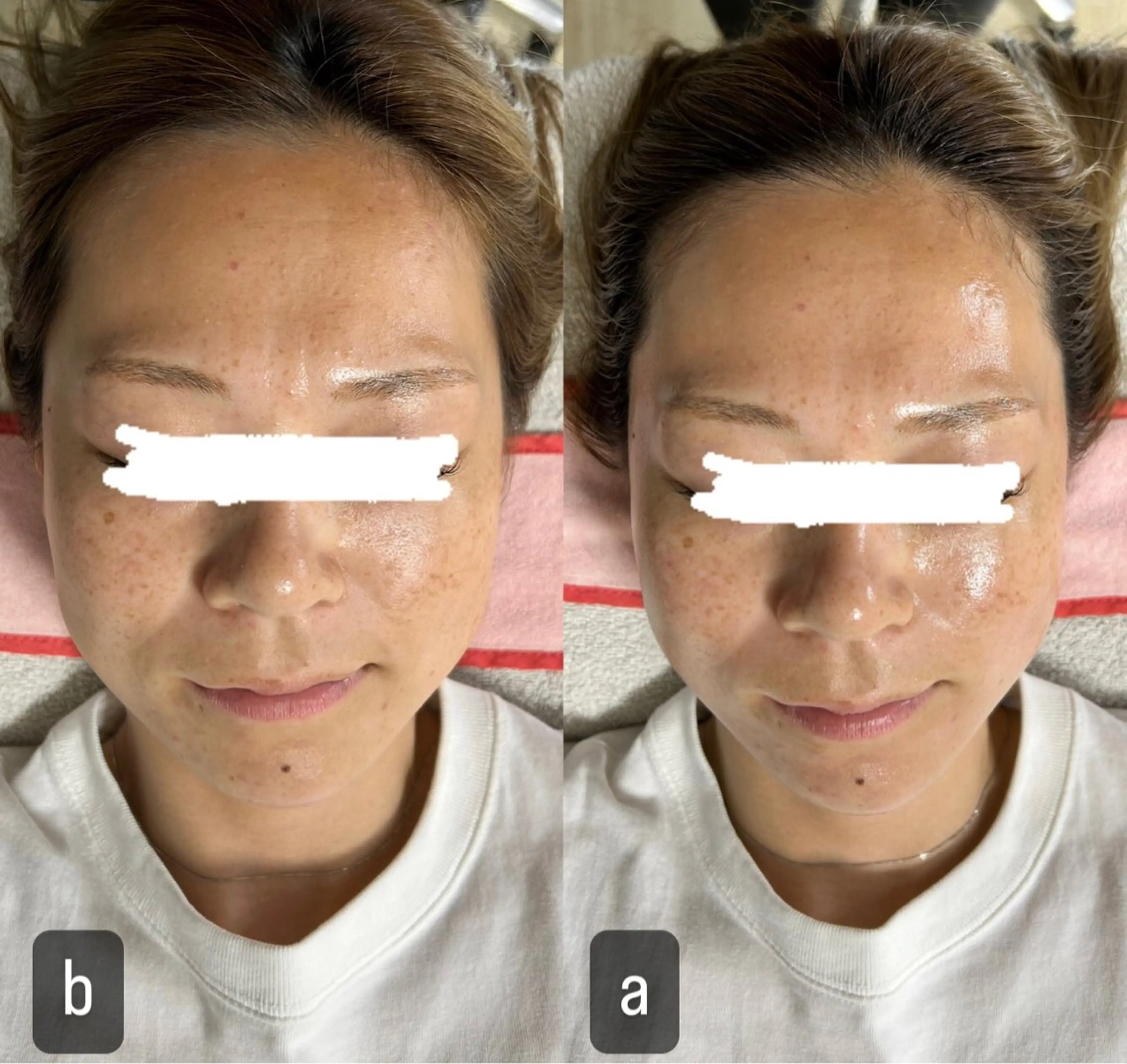 217whitening  room所属・217 ホワイトニングルームのエステ・リラクイメージ