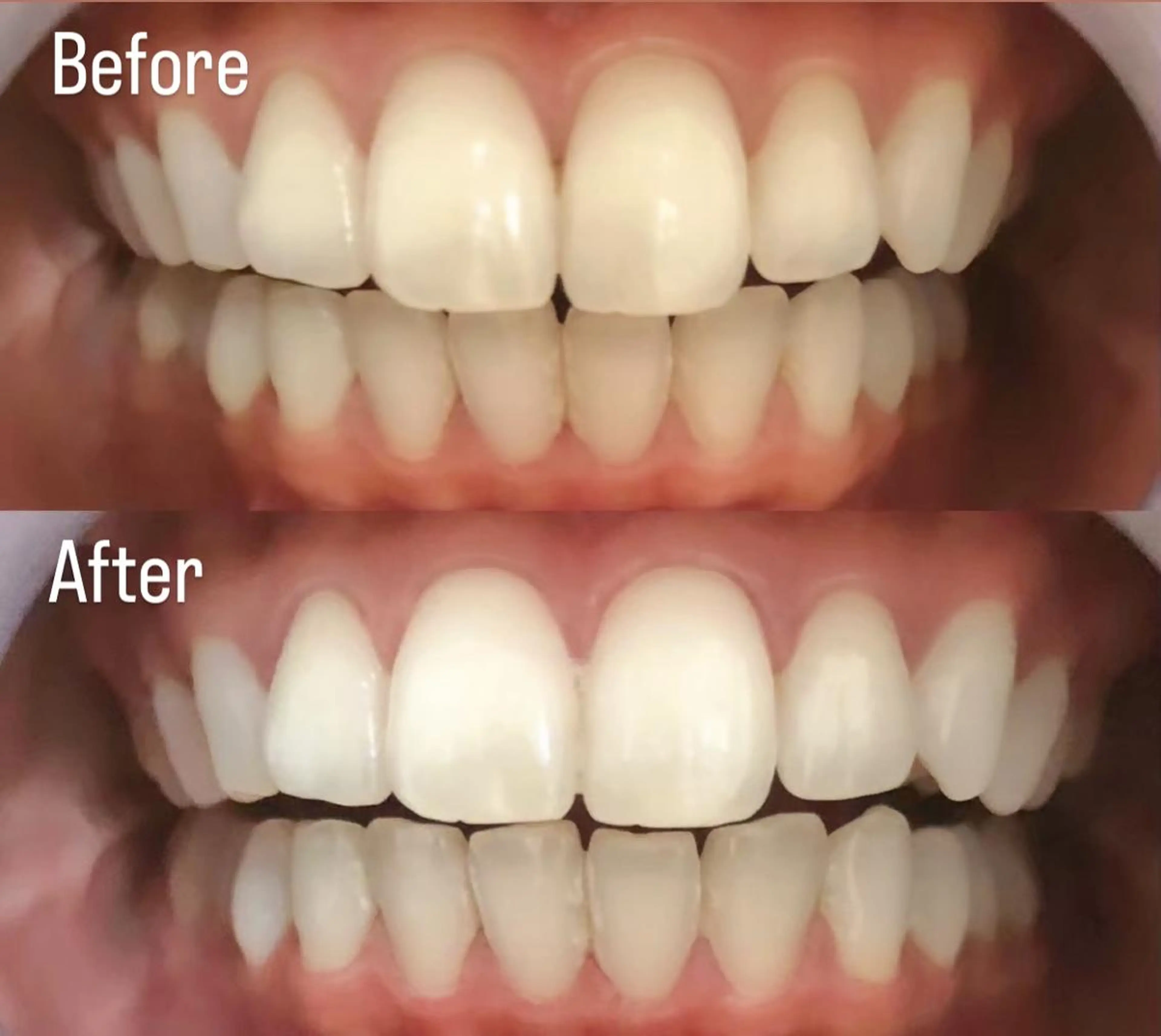 LBSホワイトニング 銀座店💎店長浦和のその他イメージ