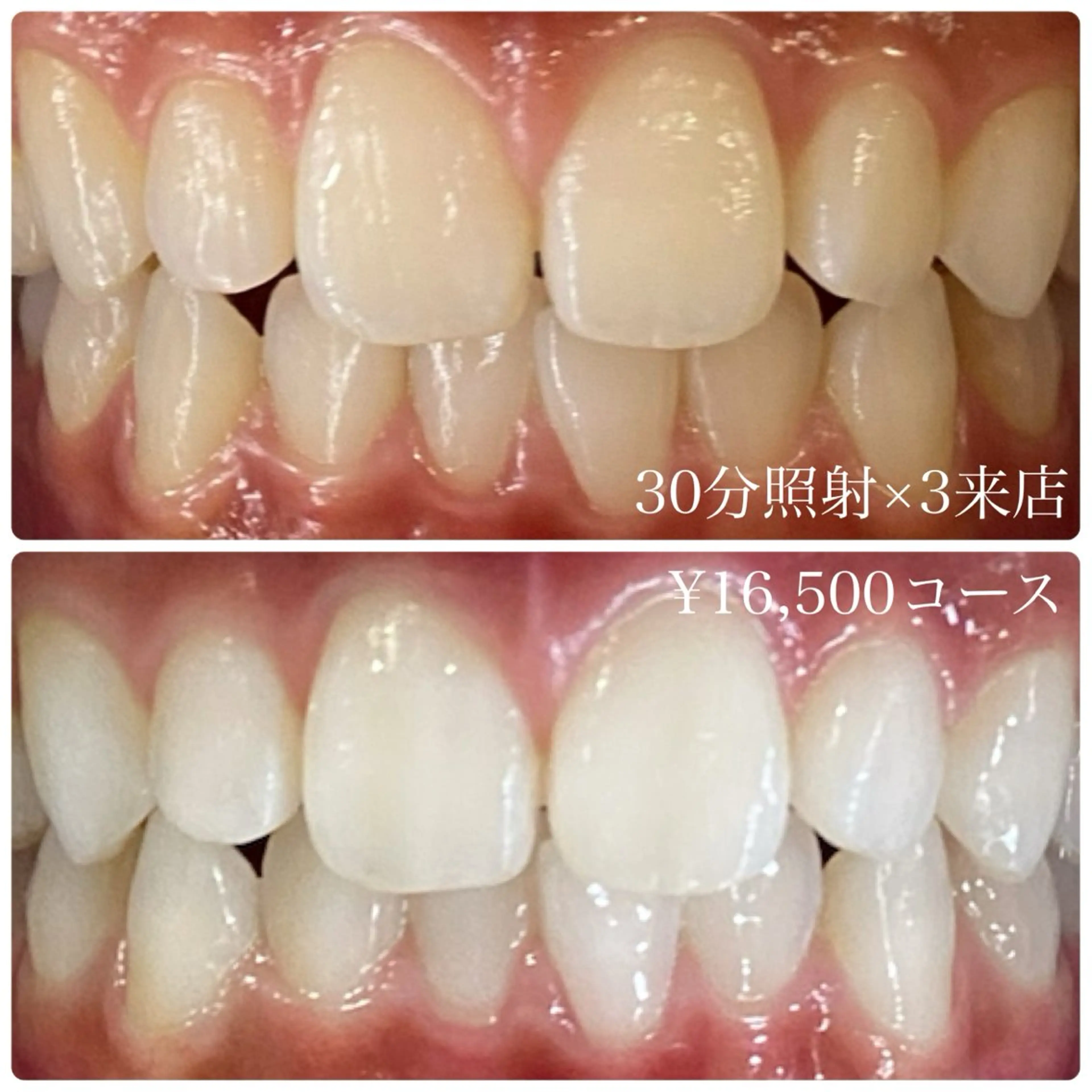 メンズ ホワイトニングルーム　川崎店所属・ホワイトニング ルーム　川崎店のその他イメージ