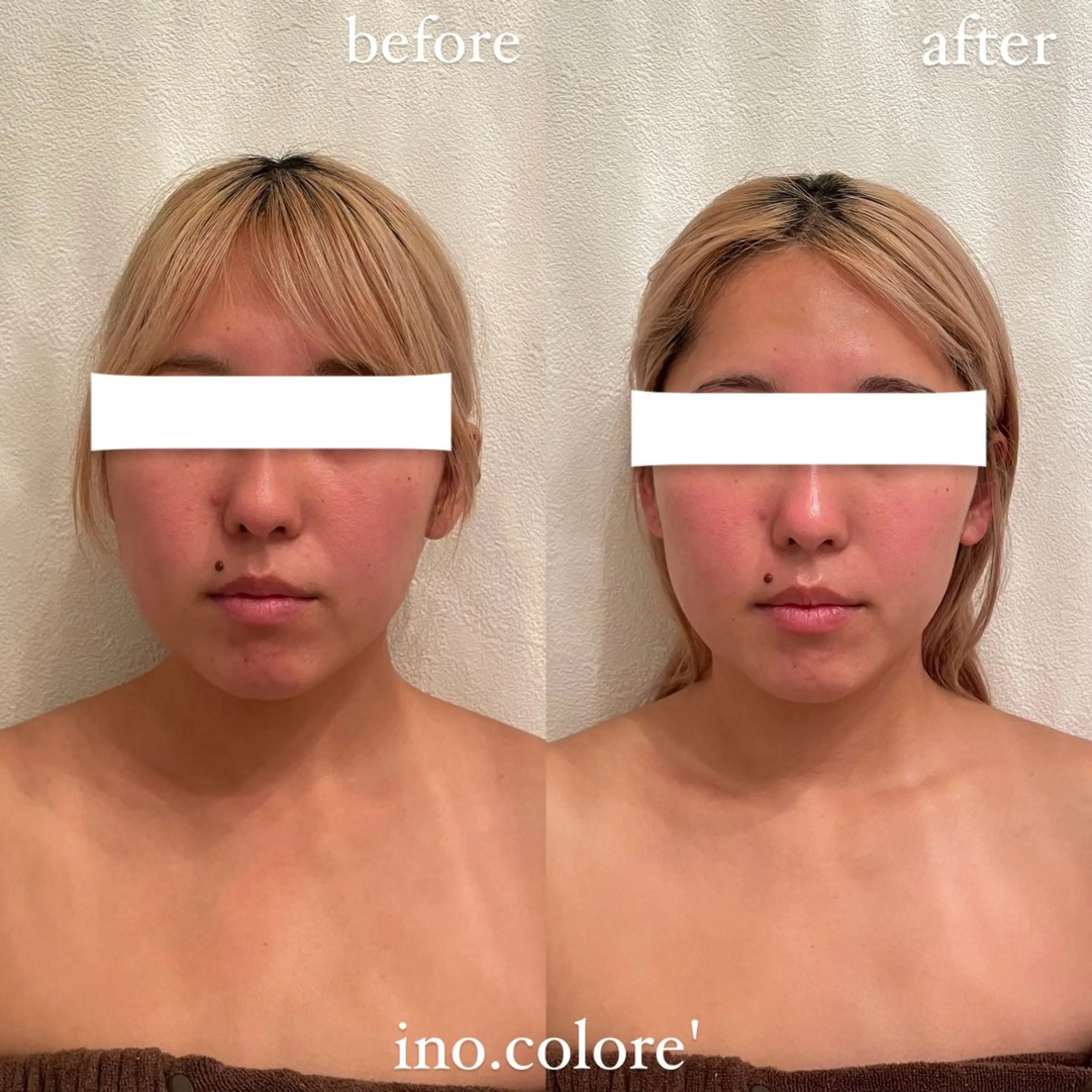 エステ リラク エステサロンino.colore'所属・小顔サロン ino.coloreのエステ・リラクイメージ