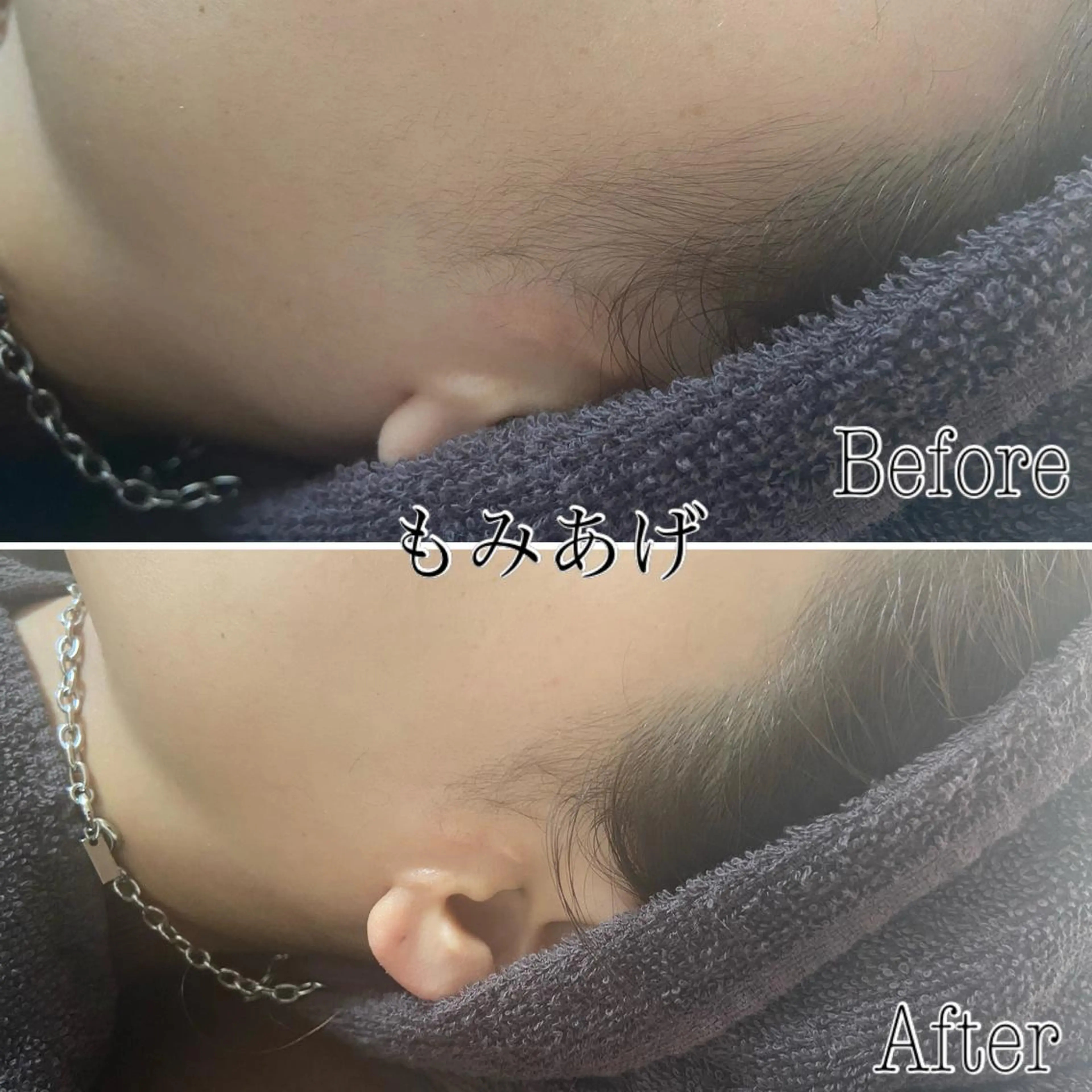 脱毛 都度払い制脱毛サロンBe Charm所属・Be Charm 山﨑のエステ・リラクイメージ