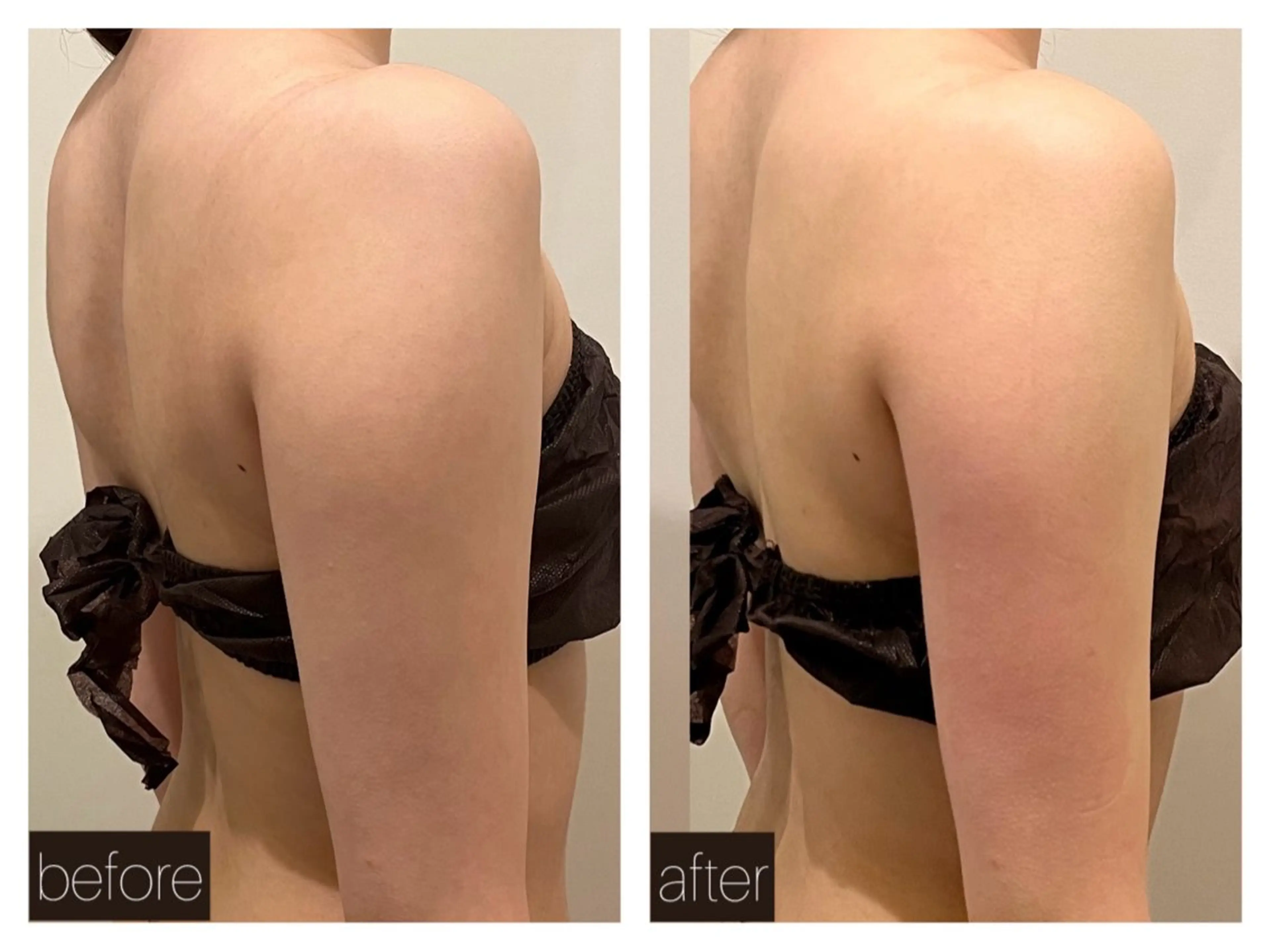 エステ ☆痩身/小顔☆ コルギのエステ・リラクイメージ