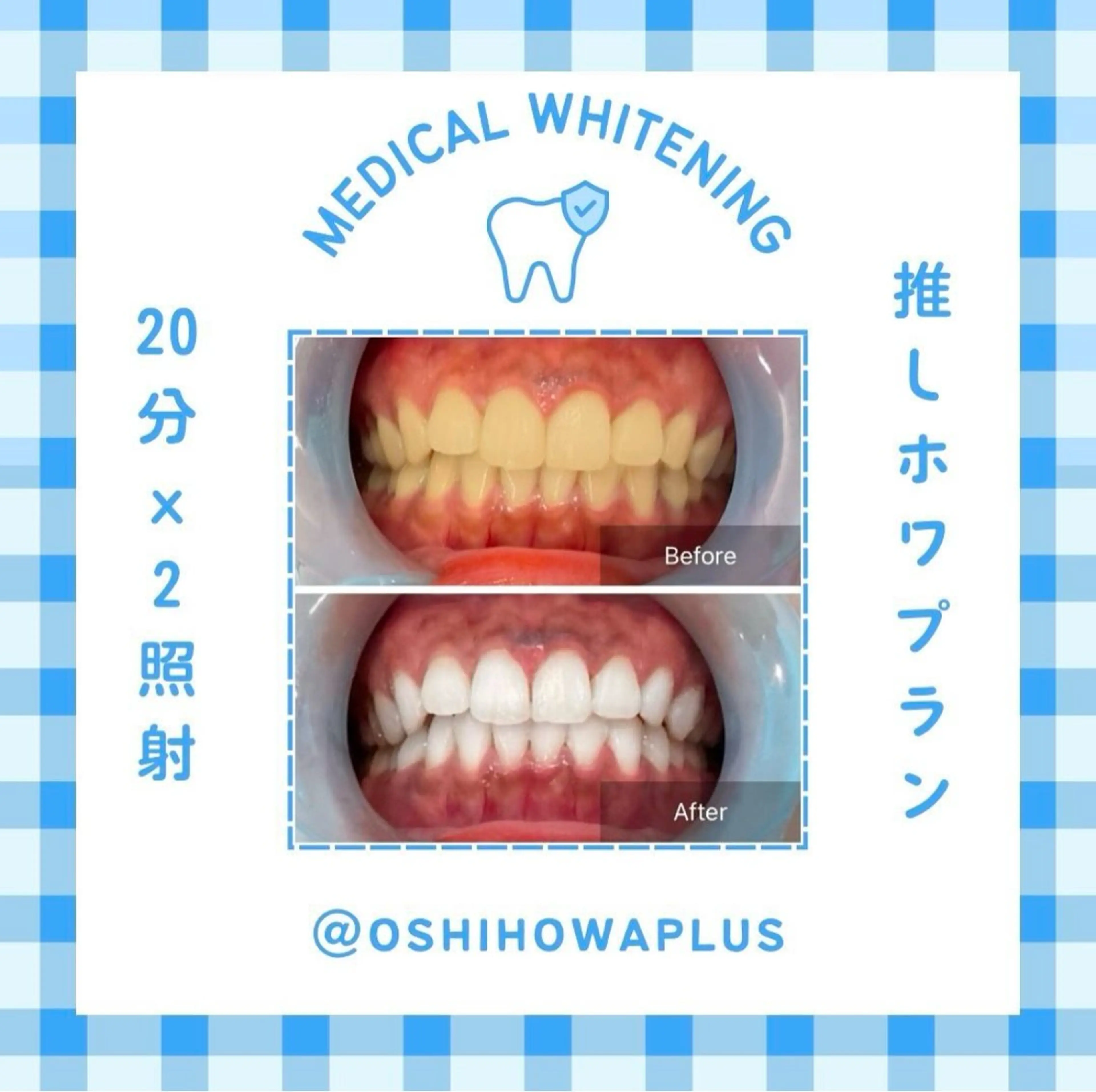 その他 Belle plus 江坂店所属・ホワイトニング/肌管 Belle plusのその他イメージ