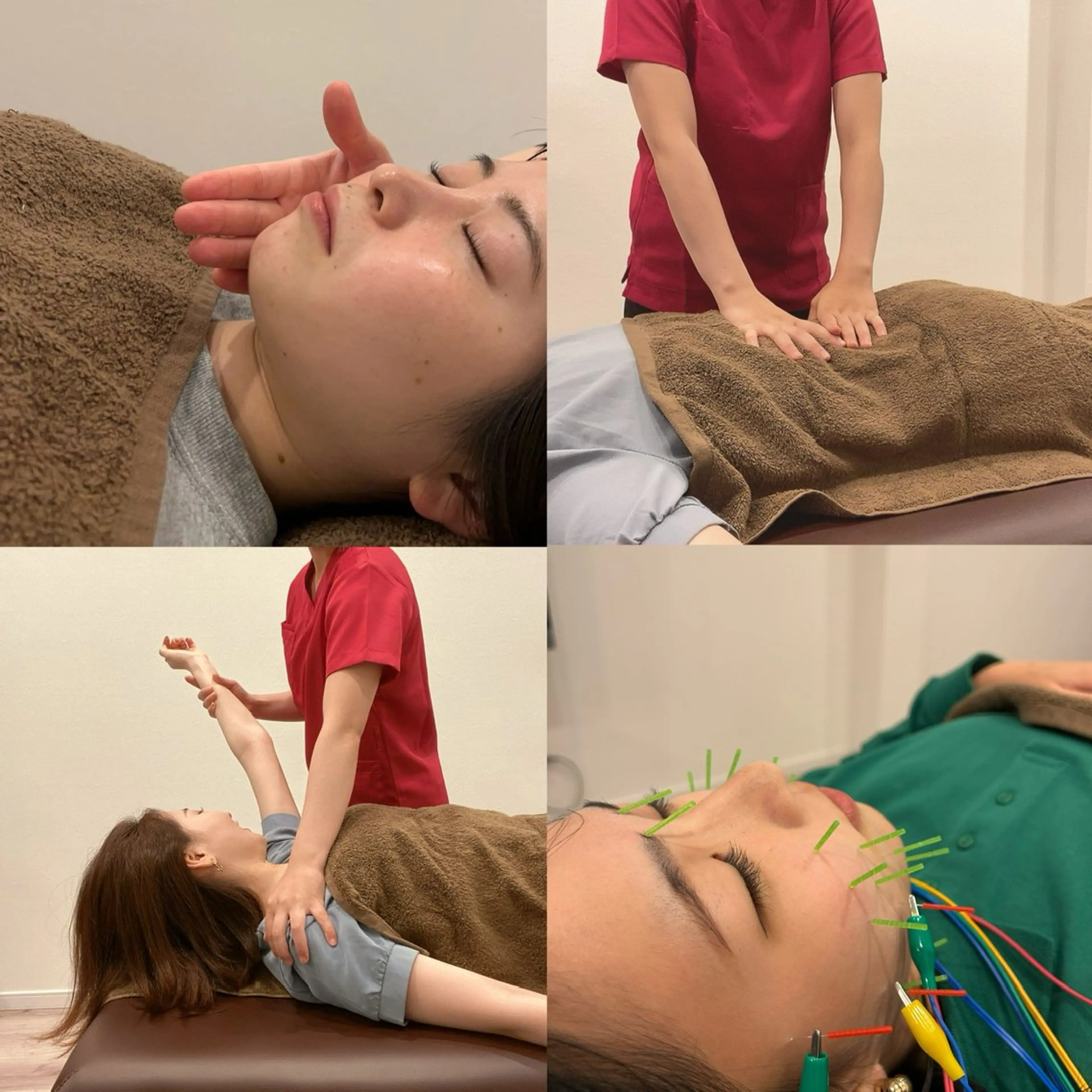 エステ リラク 美容鍼灸Solana所属・肌質改善×美容鍼 ゆいのエステ・リラクイメージ