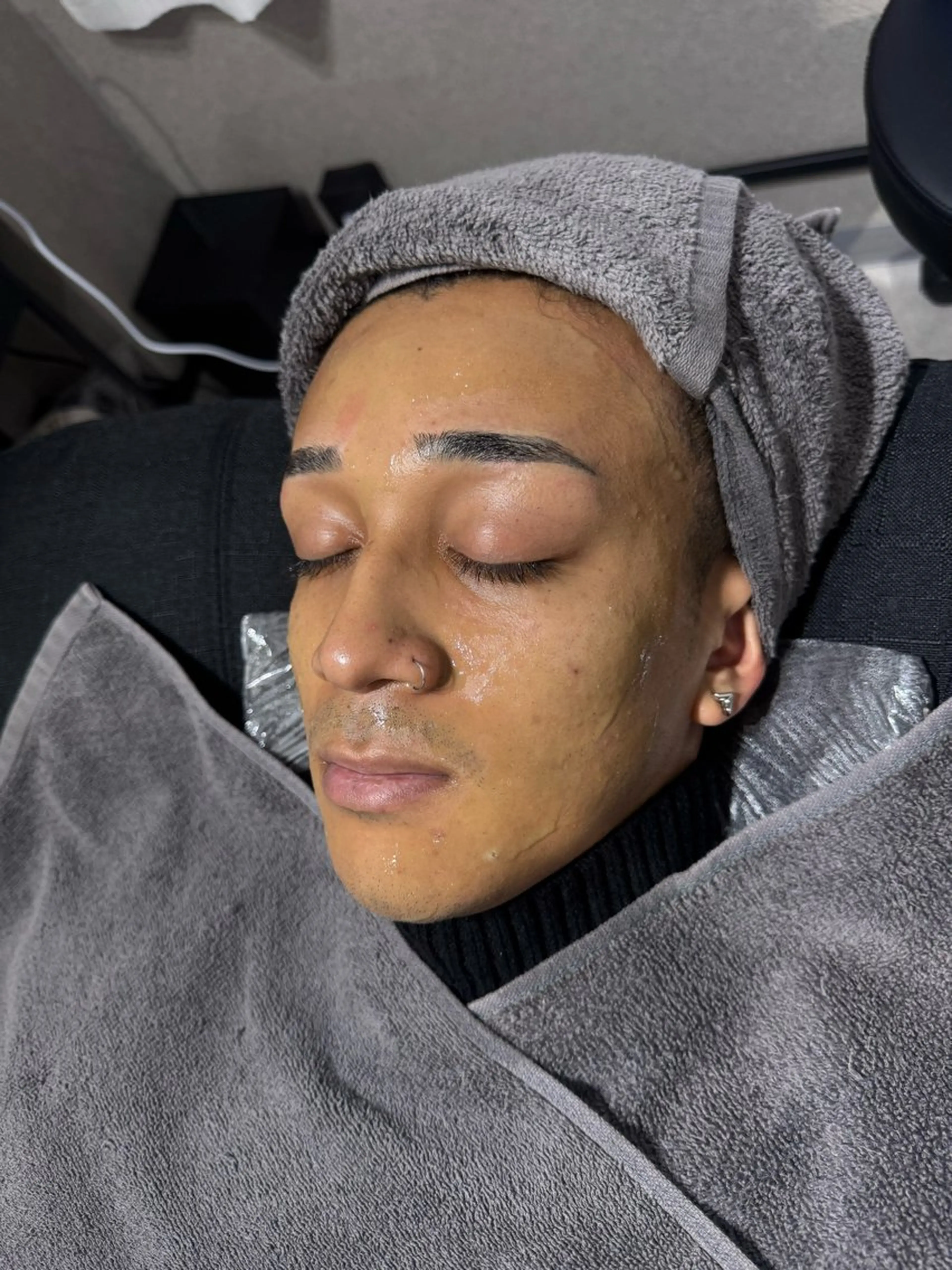 お肌に艶とはりが出るハーブピーリング！単発メニューの写真